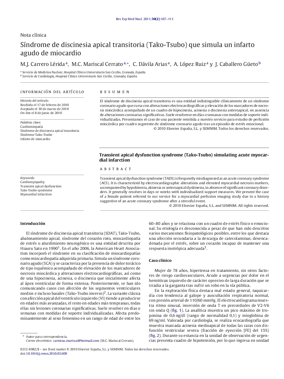 Síndrome de discinesia apical transitoria (Tako-Tsubo) que simula un infarto agudo de miocardio