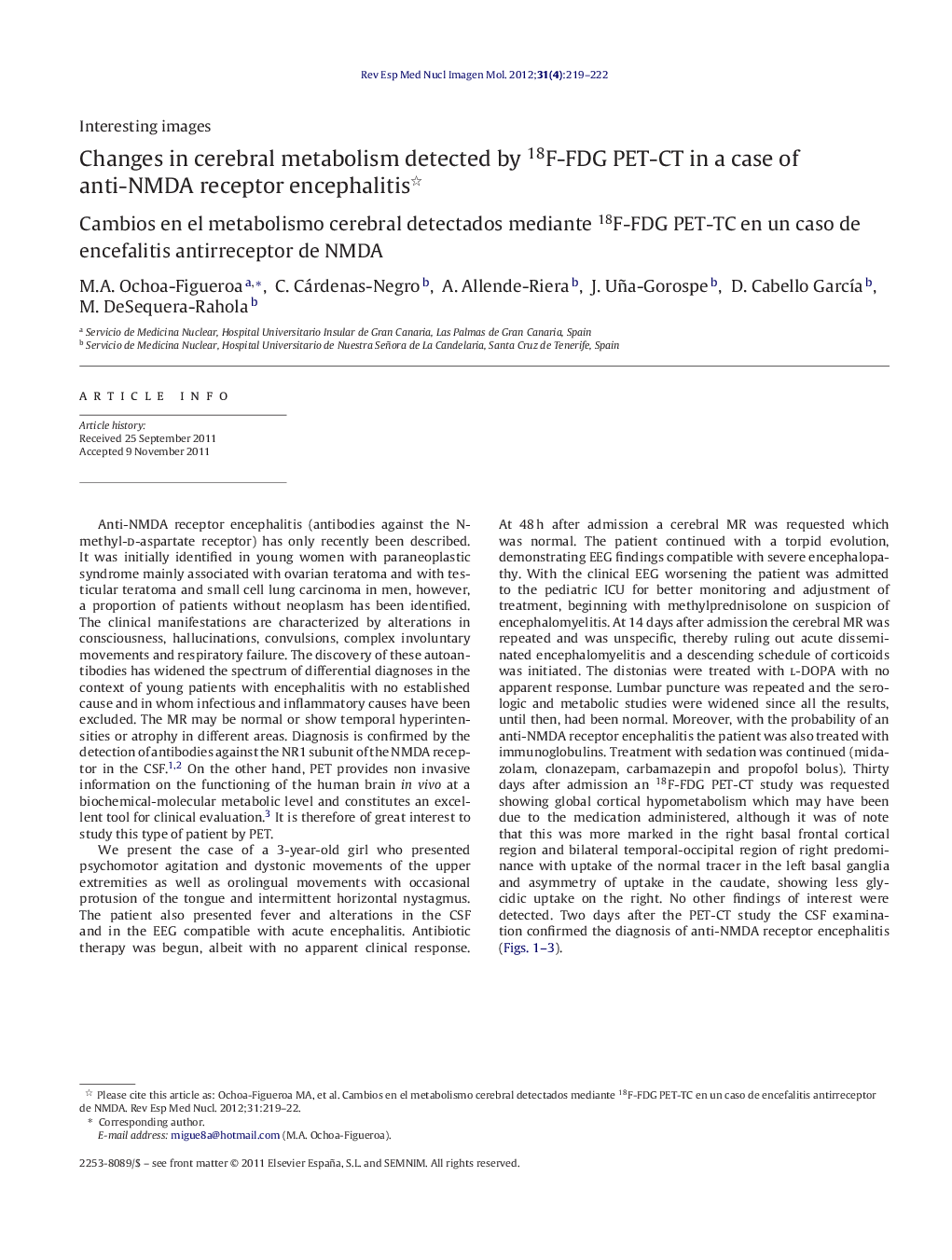 Changes in cerebral metabolism detected by 18F-FDG PET-CT in a case of anti-NMDA receptor encephalitis