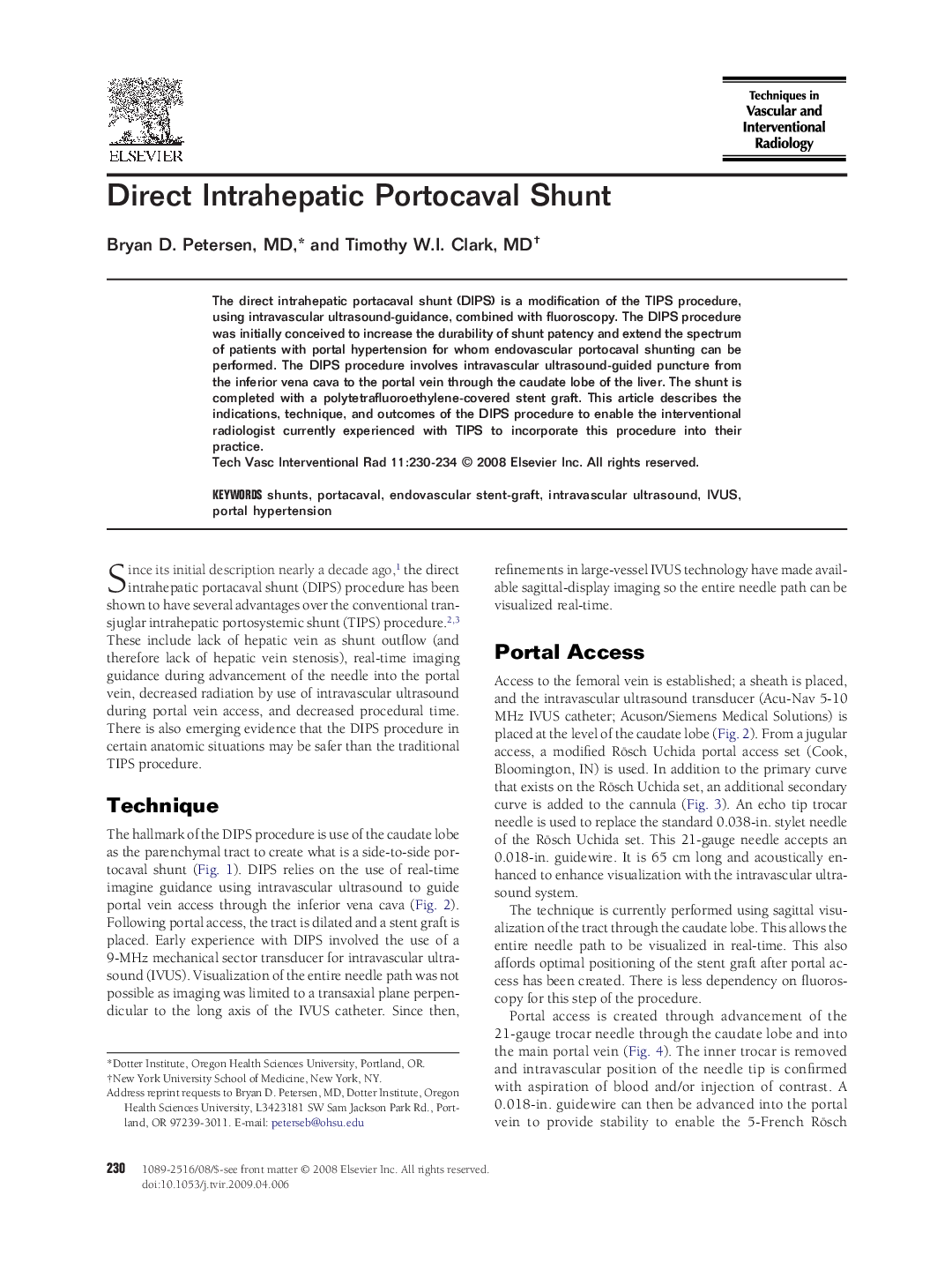 Direct Intrahepatic Portocaval Shunt