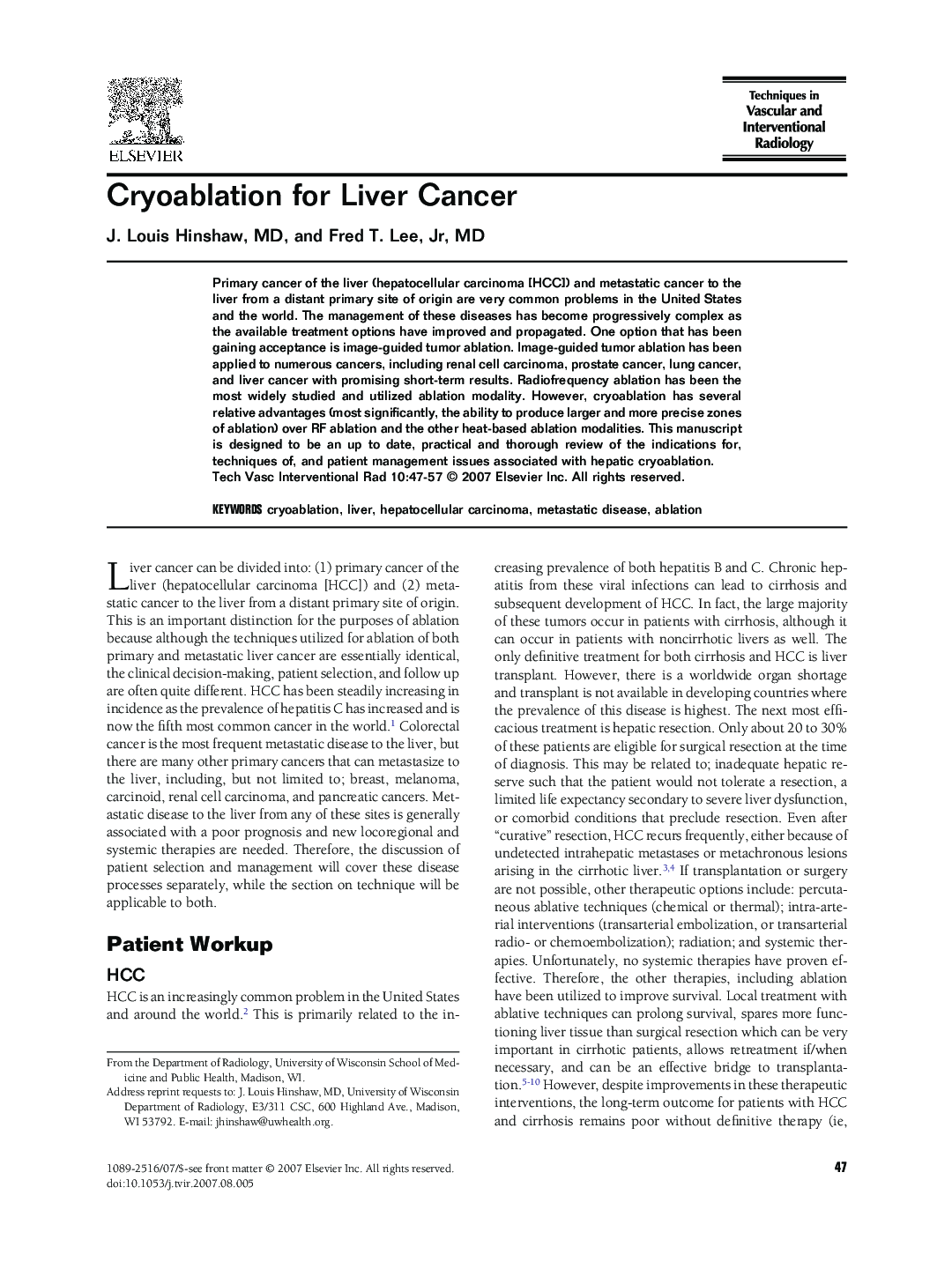 Cryoablation for Liver Cancer