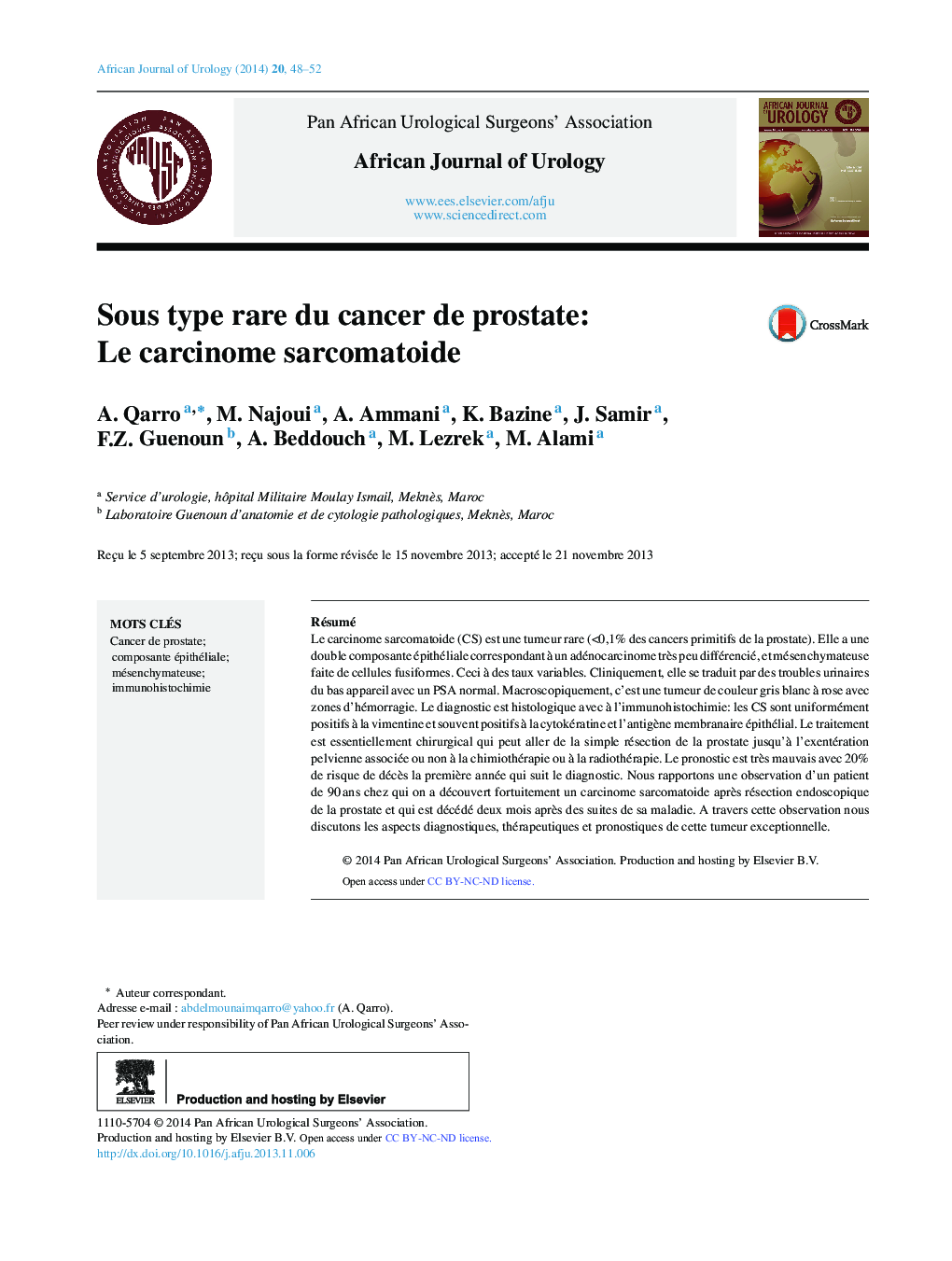 Sous type rare du cancer de prostate: Le carcinome sarcomatoide 