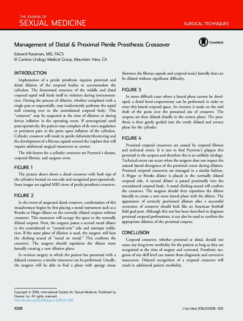 Management of Distal & Proximal Penile Prosthesis Crossover