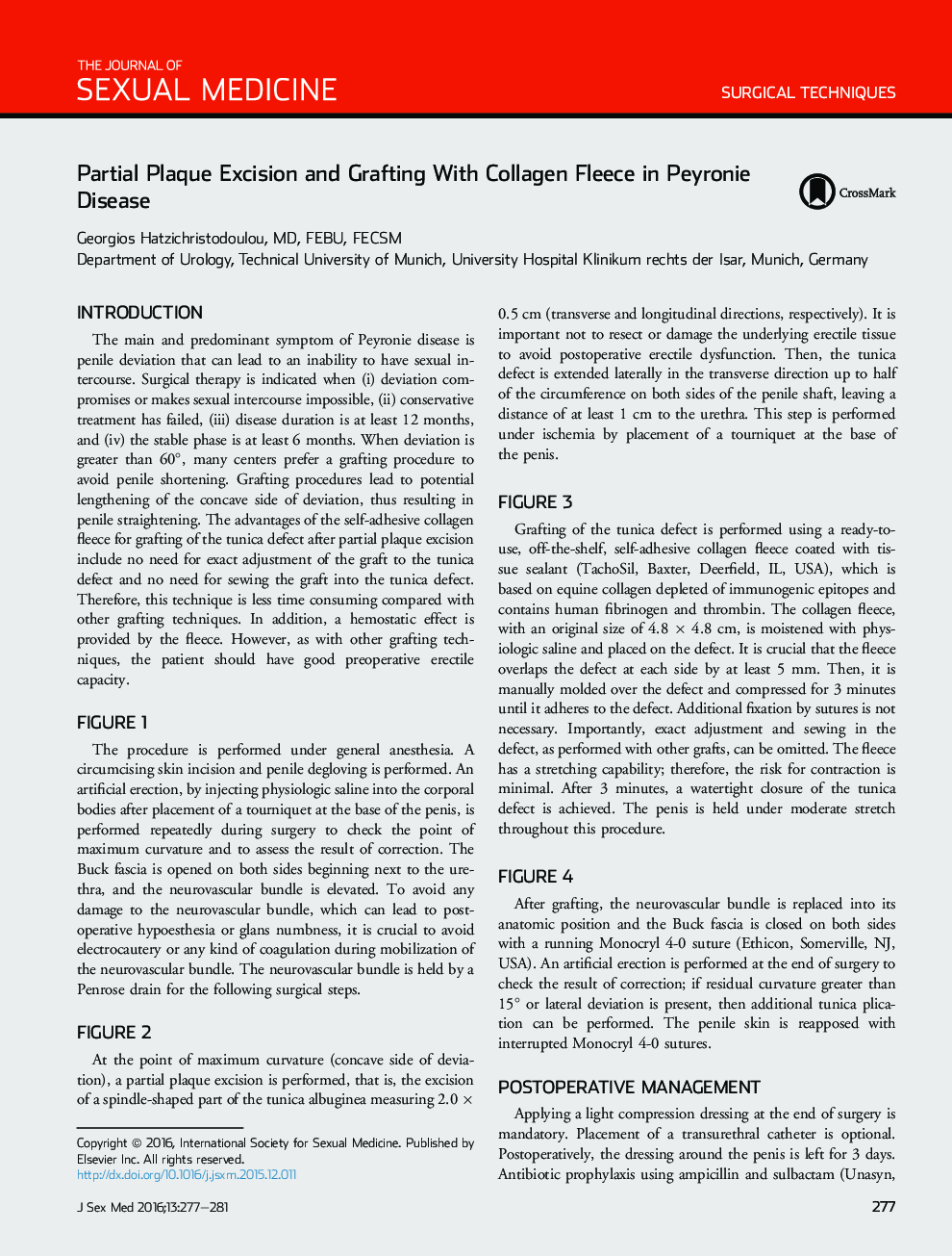 Partial Plaque Excision and Grafting With Collagen Fleece in Peyronie Disease