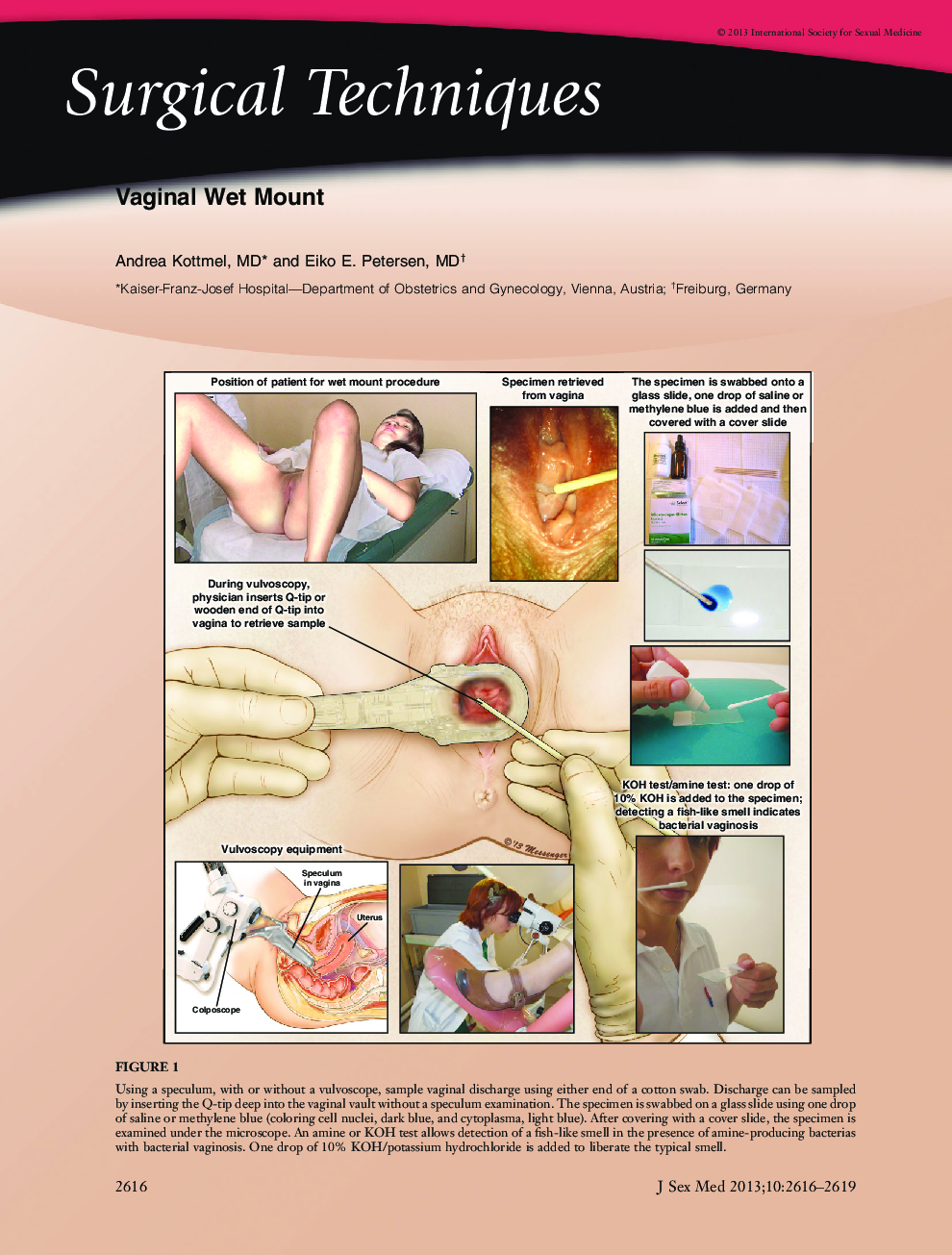 Vaginal Wet Mount