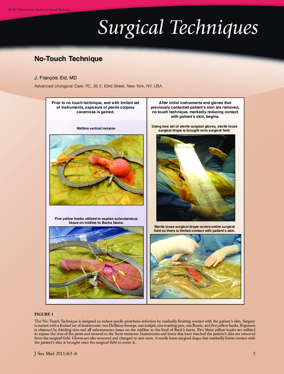 Surgical Techniques