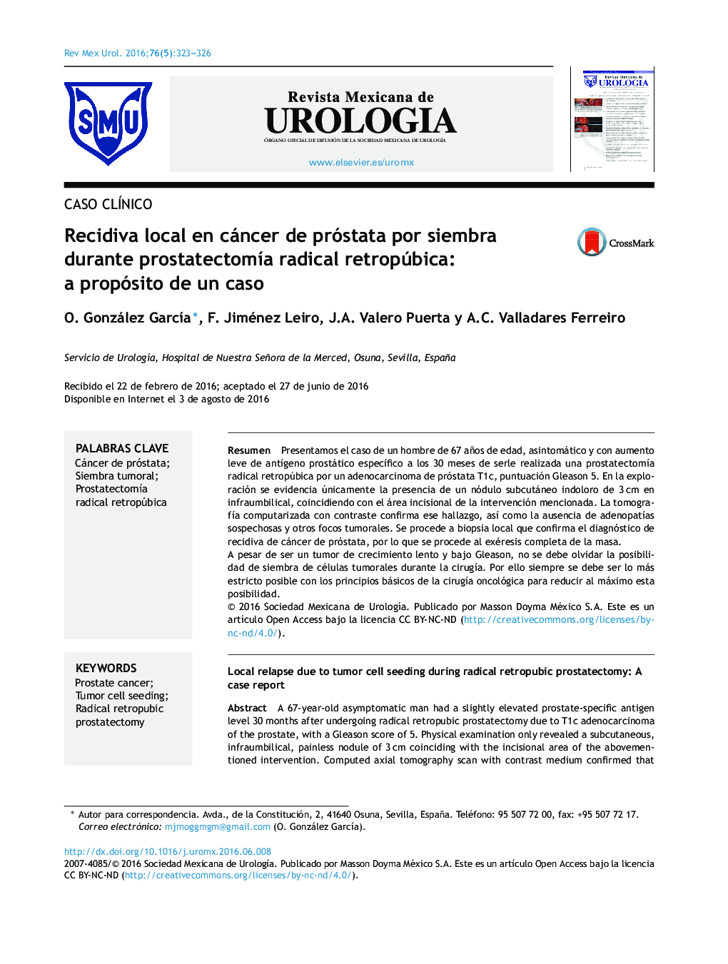 Recidiva local en cáncer de próstata por siembra durante prostatectomía radical retropúbica: a propósito de un caso