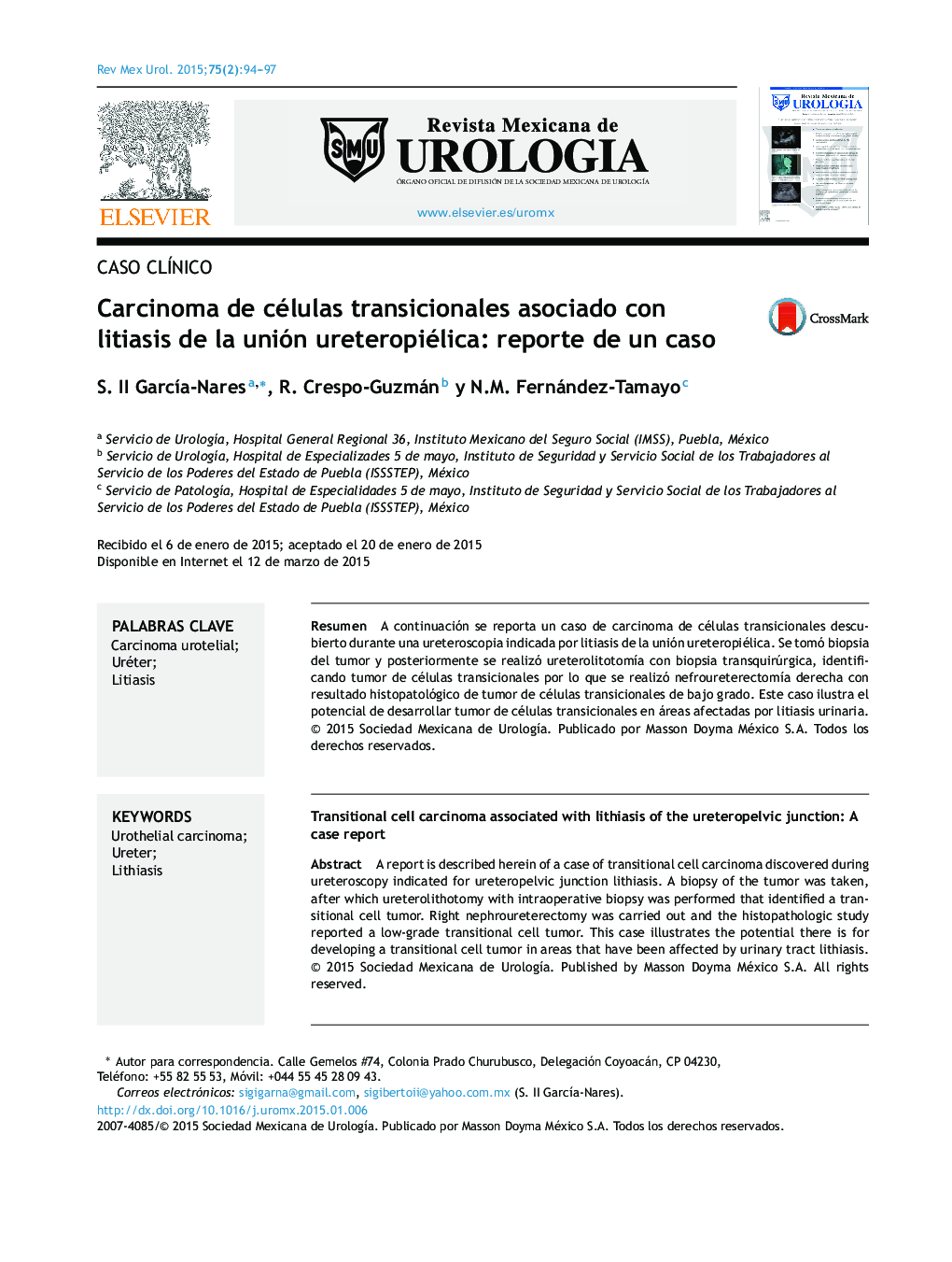 Carcinoma de células transicionales asociado con litiasis de la unión ureteropiélica: reporte de un caso