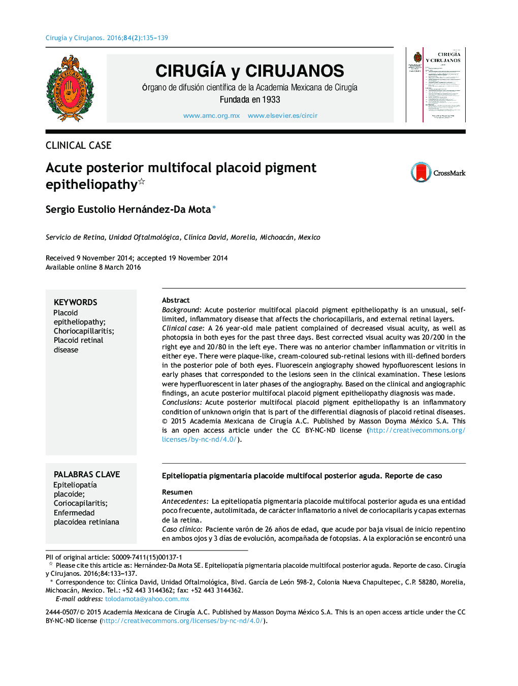 Acute posterior multifocal placoid pigment epitheliopathy 