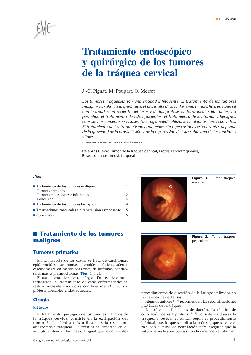 Tratamiento endoscópico y quirúrgico de los tumores de la tráquea cervical