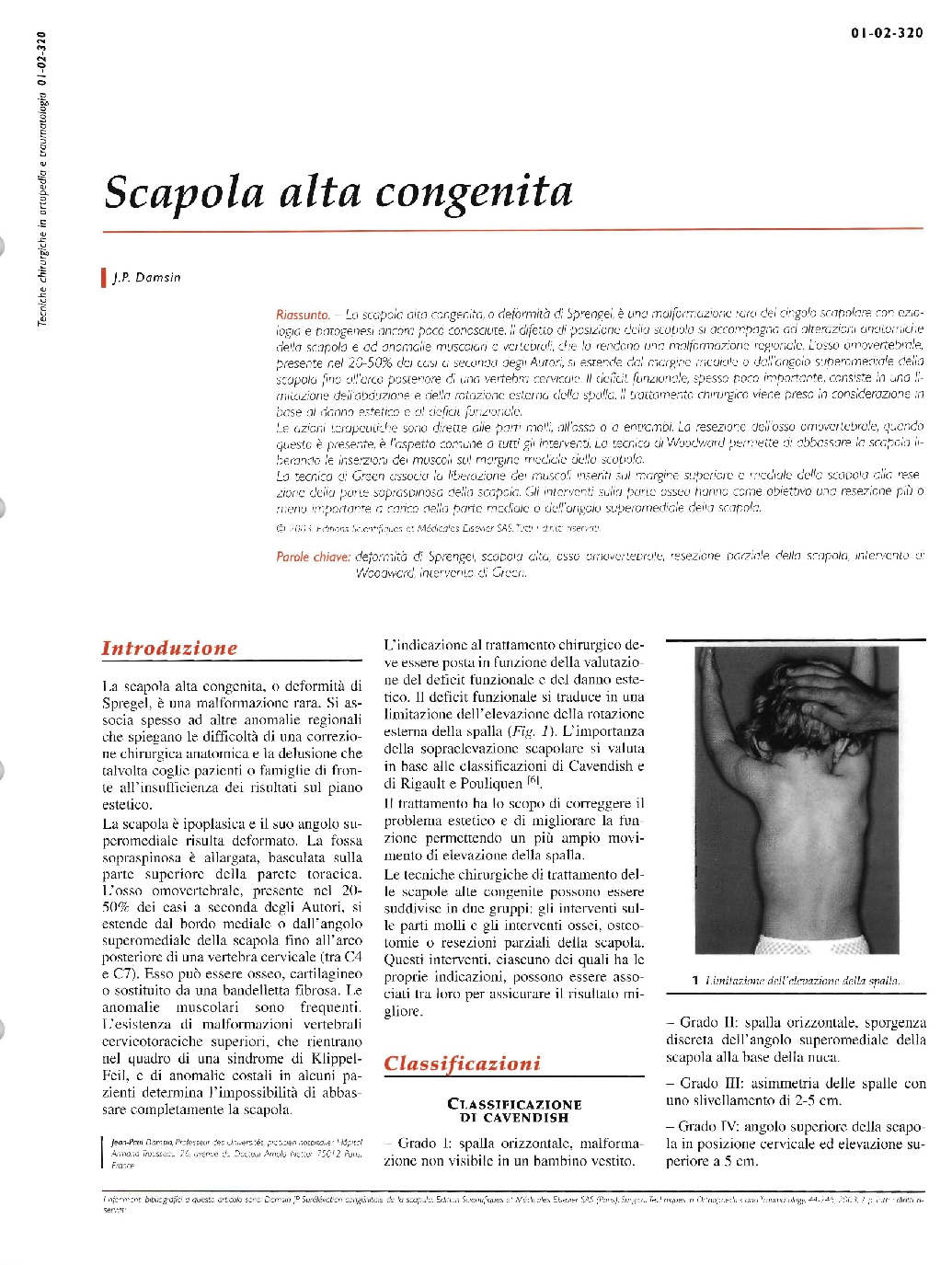 عکس صفحه اول مقاله: Scapola alta congenita Scapola alta congenita