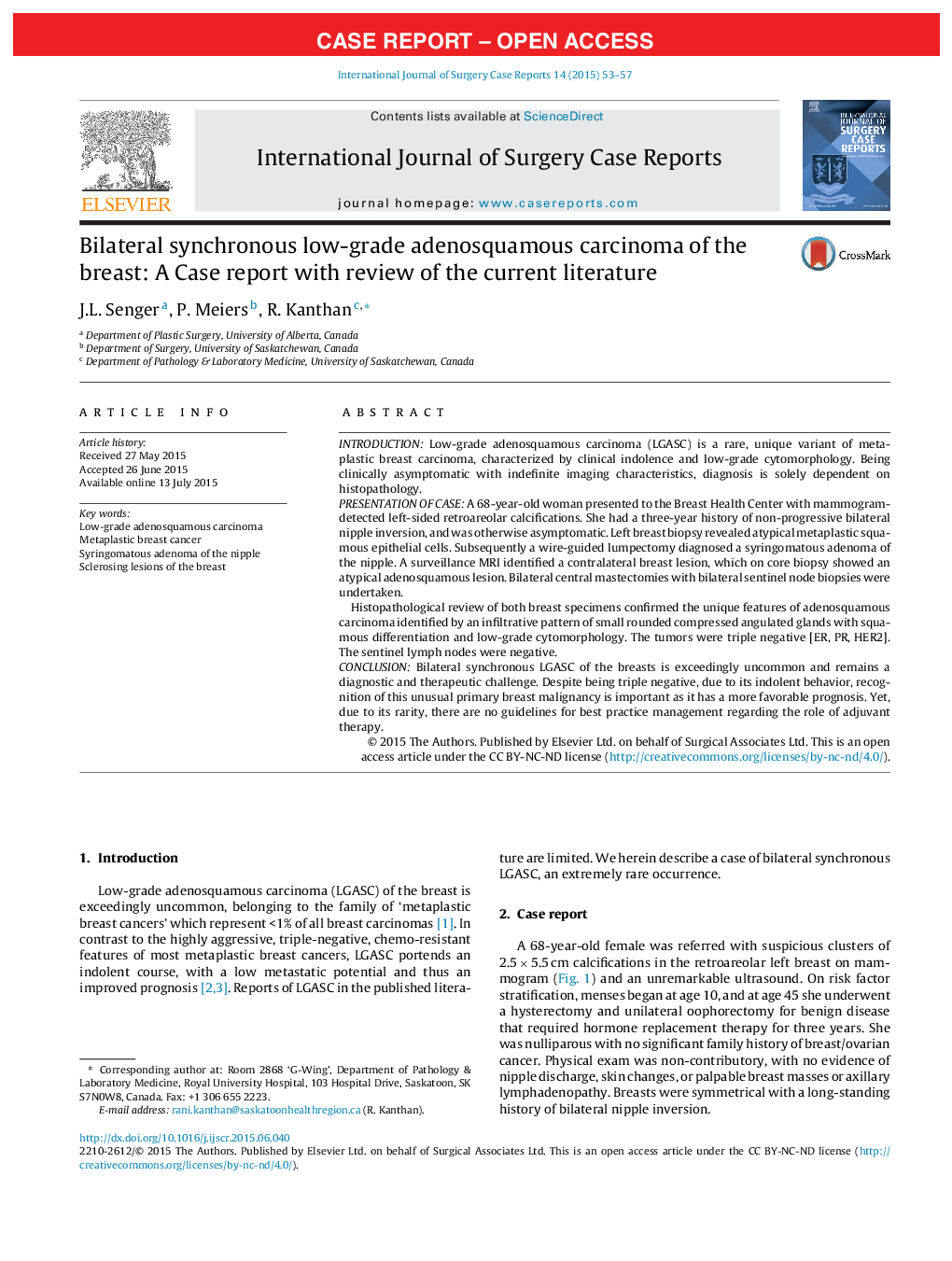 Bilateral synchronous low-grade adenosquamous carcinoma of the breast: A Case report with review of the current literature