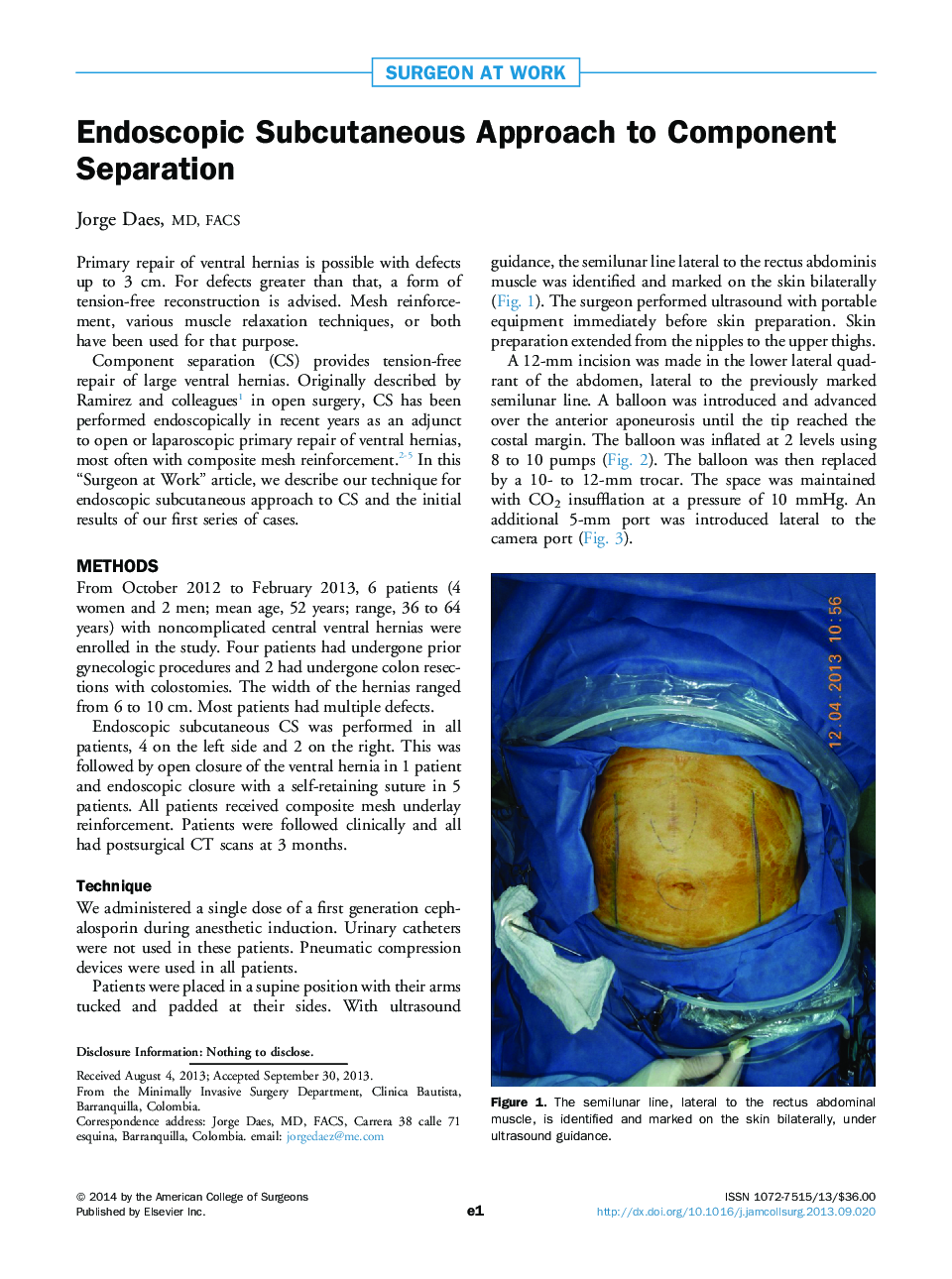 Endoscopic Subcutaneous Approach to Component Separation