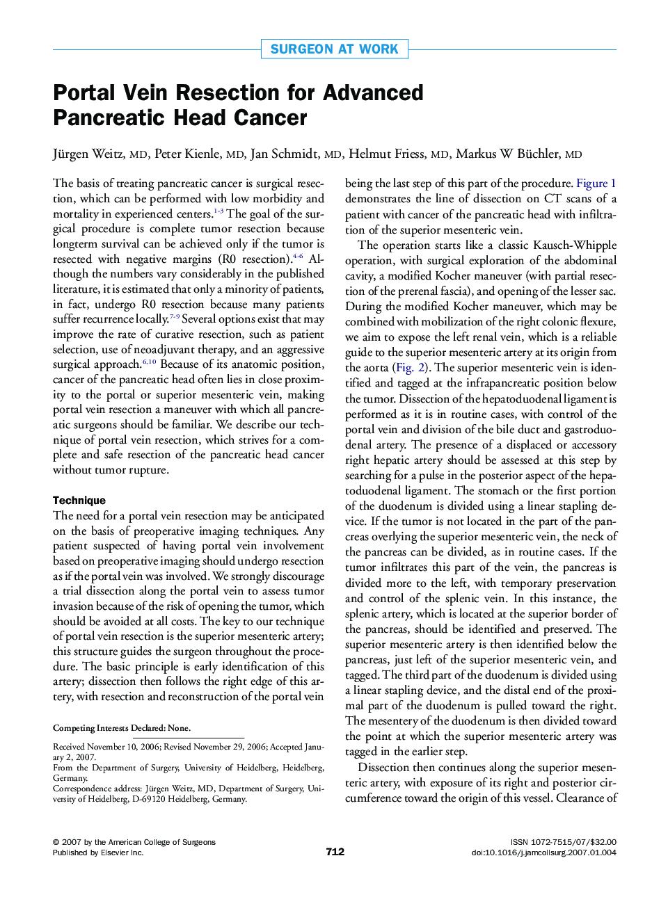 Portal Vein Resection for Advanced Pancreatic Head Cancer
