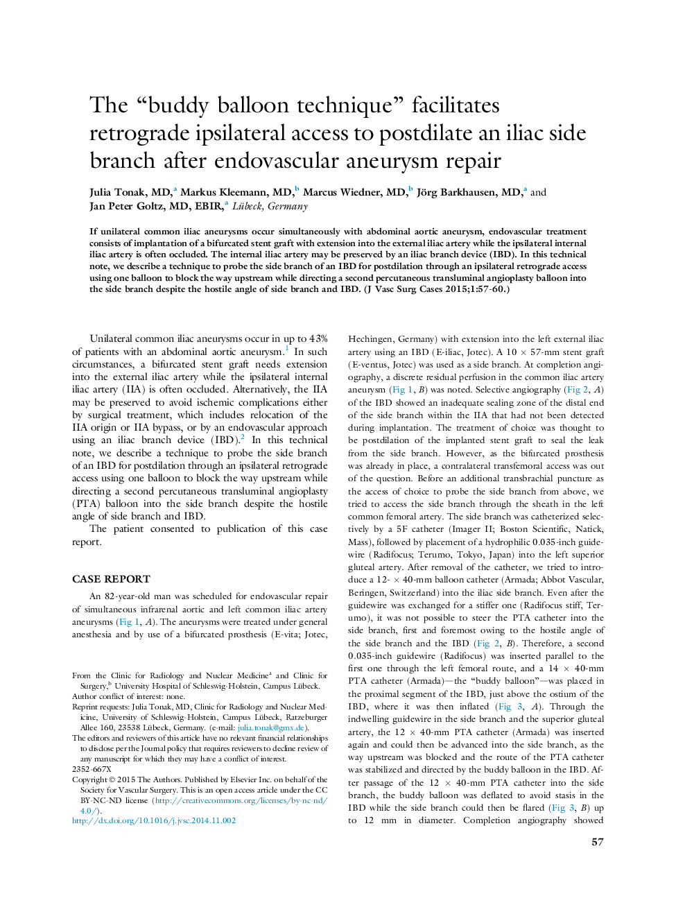 The “buddy balloon technique” facilitates retrograde ipsilateral access to postdilate an iliac side branch after endovascular aneurysm repair 