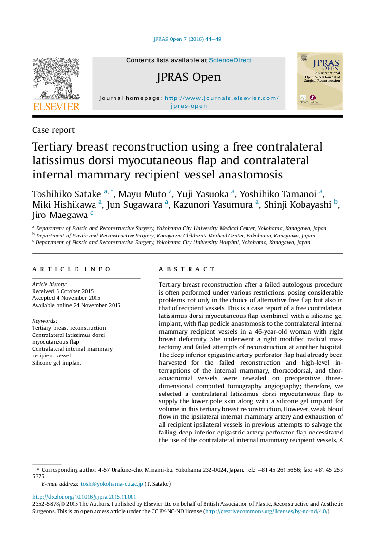 Tertiary breast reconstruction using a free contralateral latissimus dorsi myocutaneous flap and contralateral internal mammary recipient vessel anastomosis