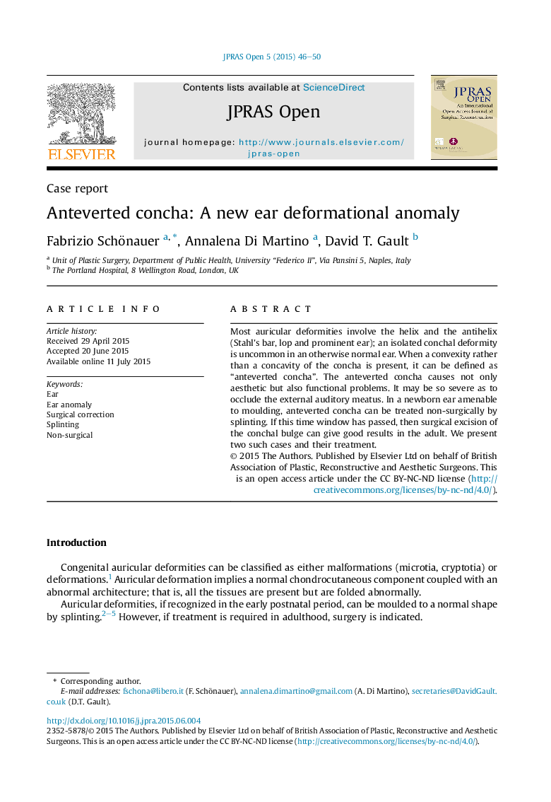 Anteverted concha: A new ear deformational anomaly