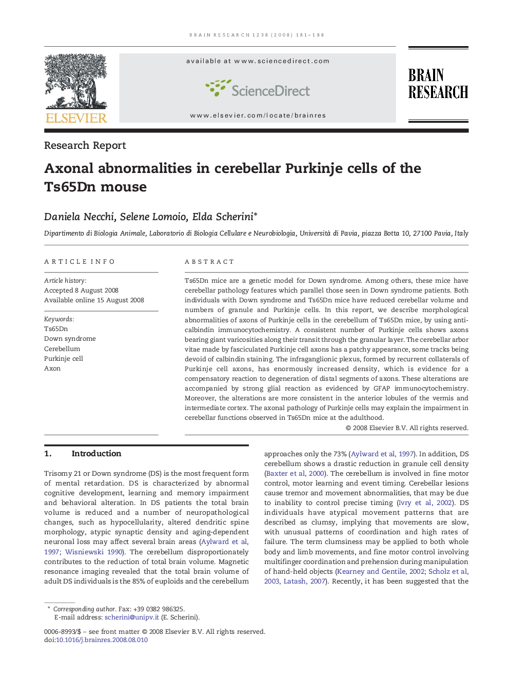 Axonal abnormalities in cerebellar Purkinje cells of the Ts65Dn mouse