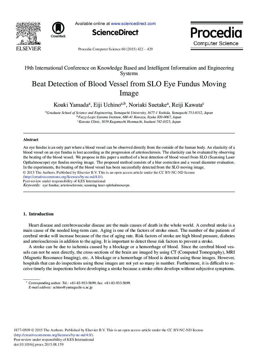 Beat Detection of Blood Vessel from SLO Eye Fundus Moving Image 