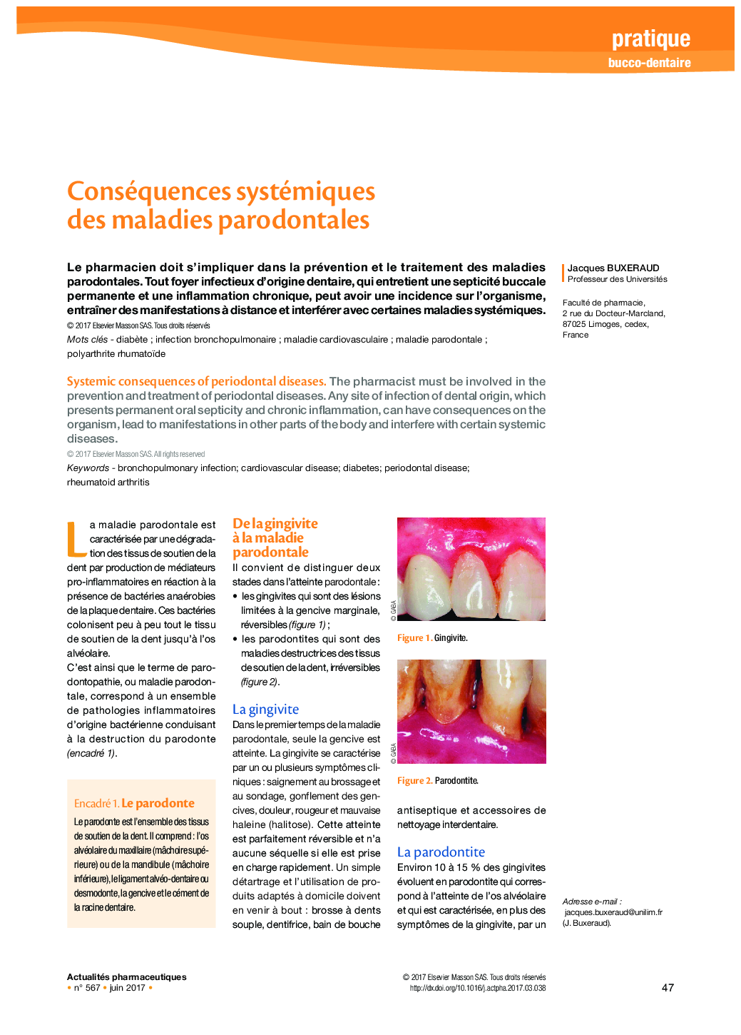 Conséquences systémiques des maladies parodontales