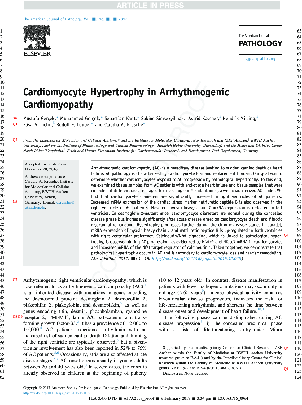 Cardiomyocyte Hypertrophy in Arrhythmogenic Cardiomyopathy