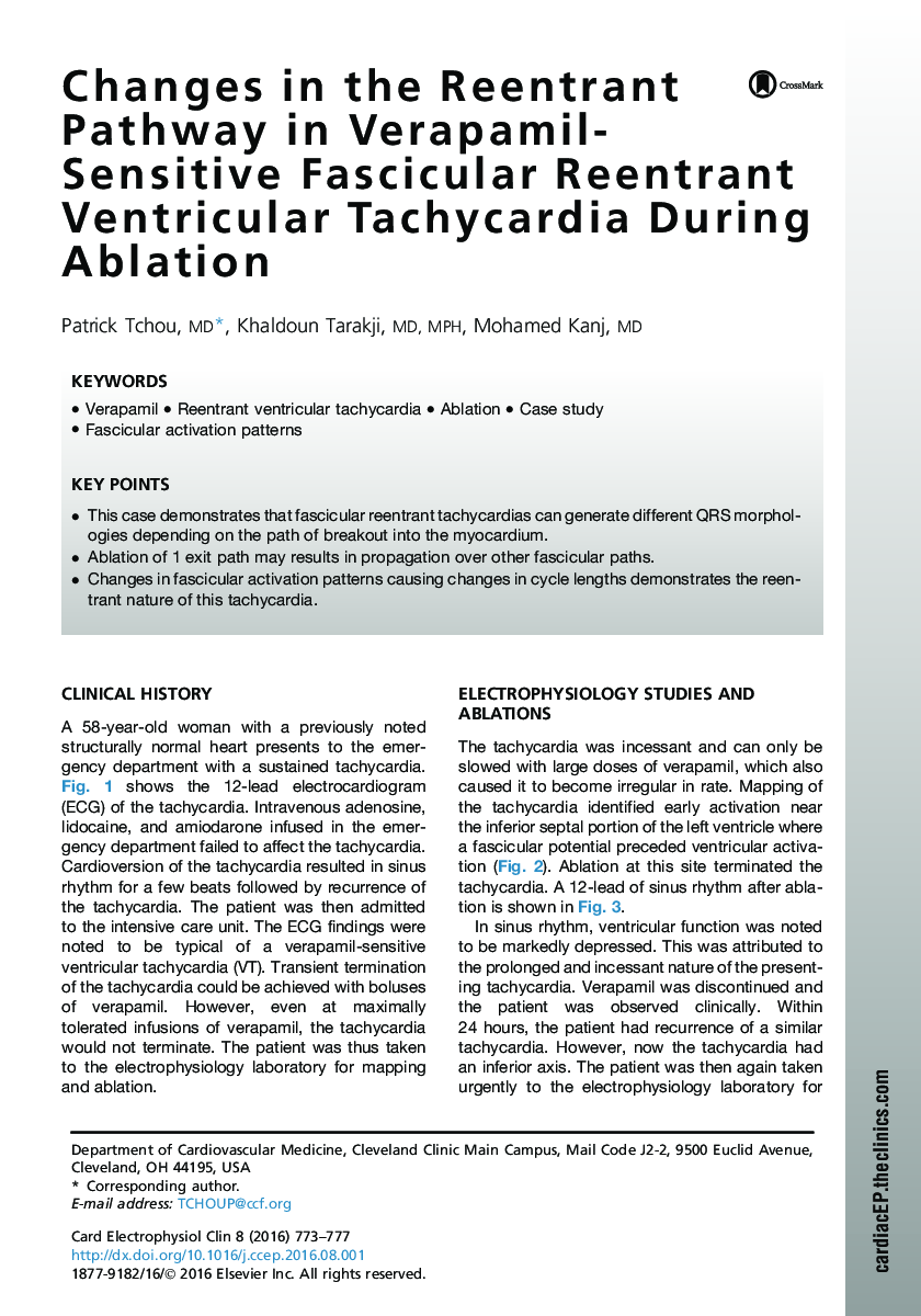 Changes in the Reentrant Pathway in Verapamil-Sensitive Fascicular Reentrant Ventricular Tachycardia During Ablation