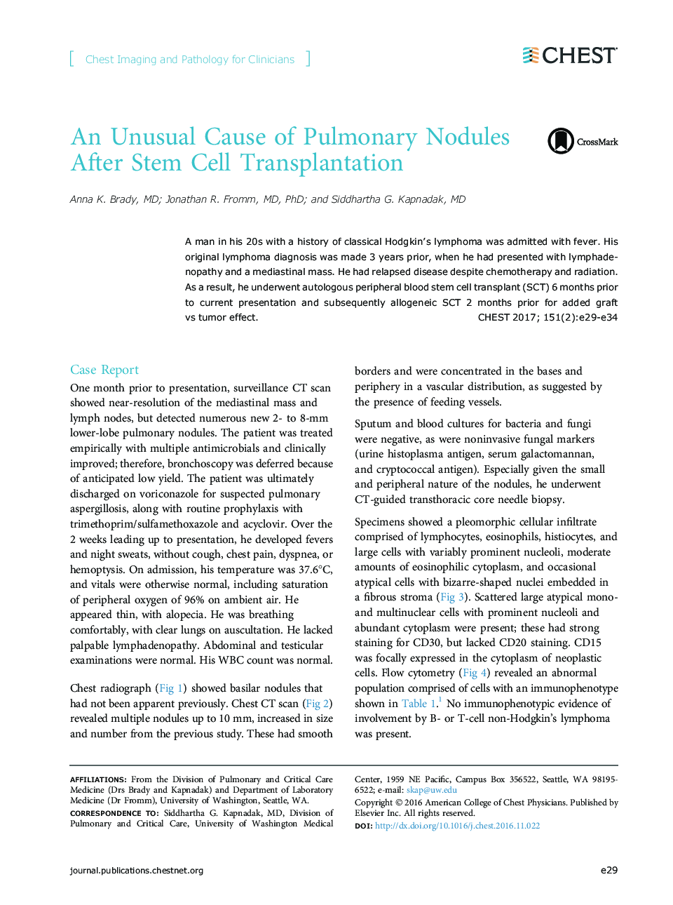 An Unusual Cause of Pulmonary Nodules After Stem Cell Transplantation