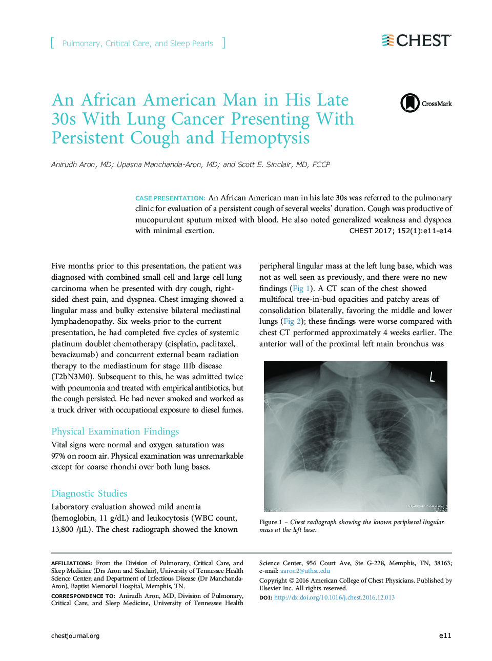 عکس صفحه اول مقاله: An African American Man in His Late 30s With Lung Cancer Presenting With Persistent Cough and Hemoptysis An African American Man in His Late 30s With Lung Cancer Presenting With Persistent Cough and Hemoptysis