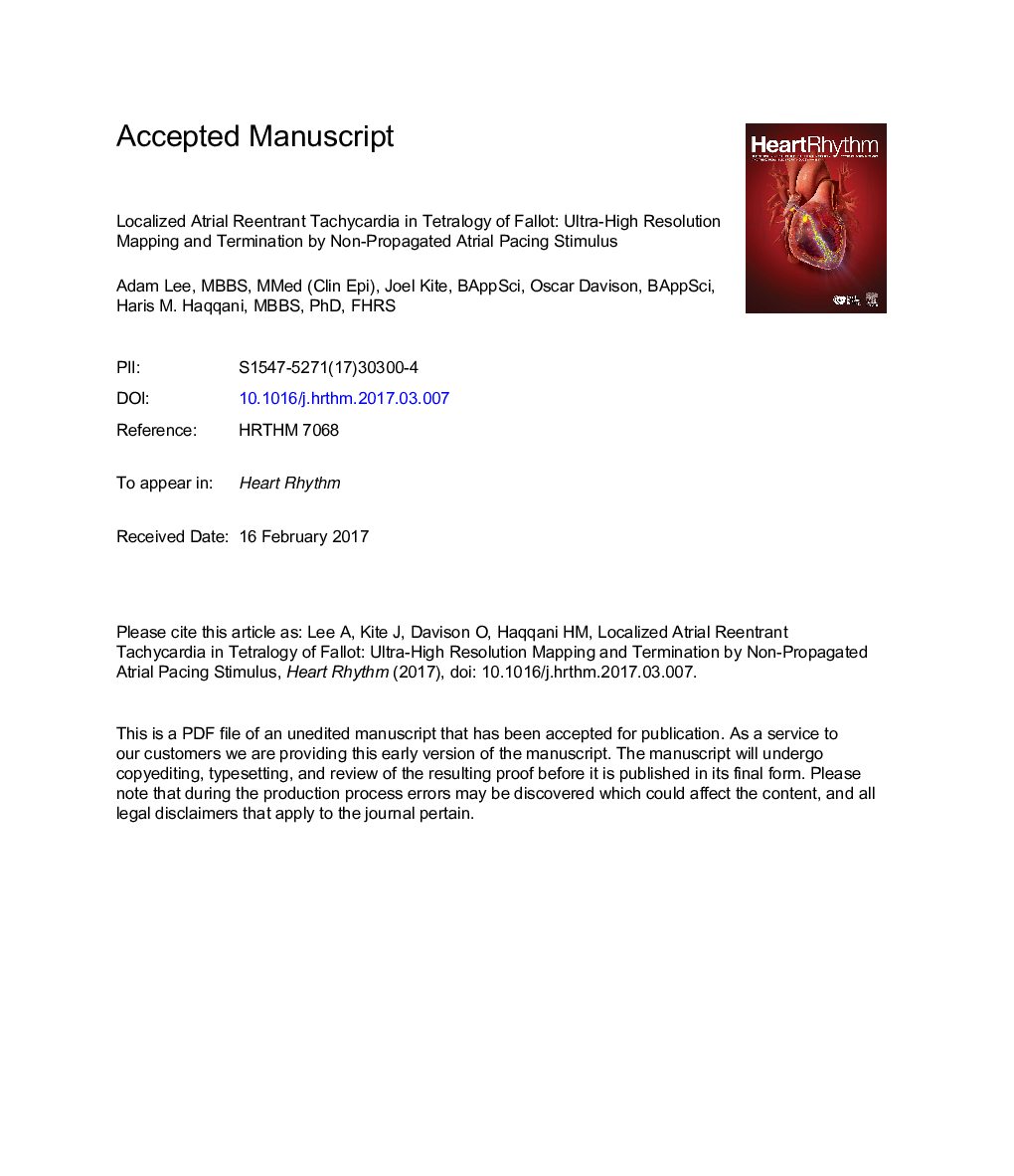 Localized atrial reentrant tachycardia in tetralogy of Fallot: Ultra-high-resolution mapping and termination by nonpropagated atrial pacing stimulus