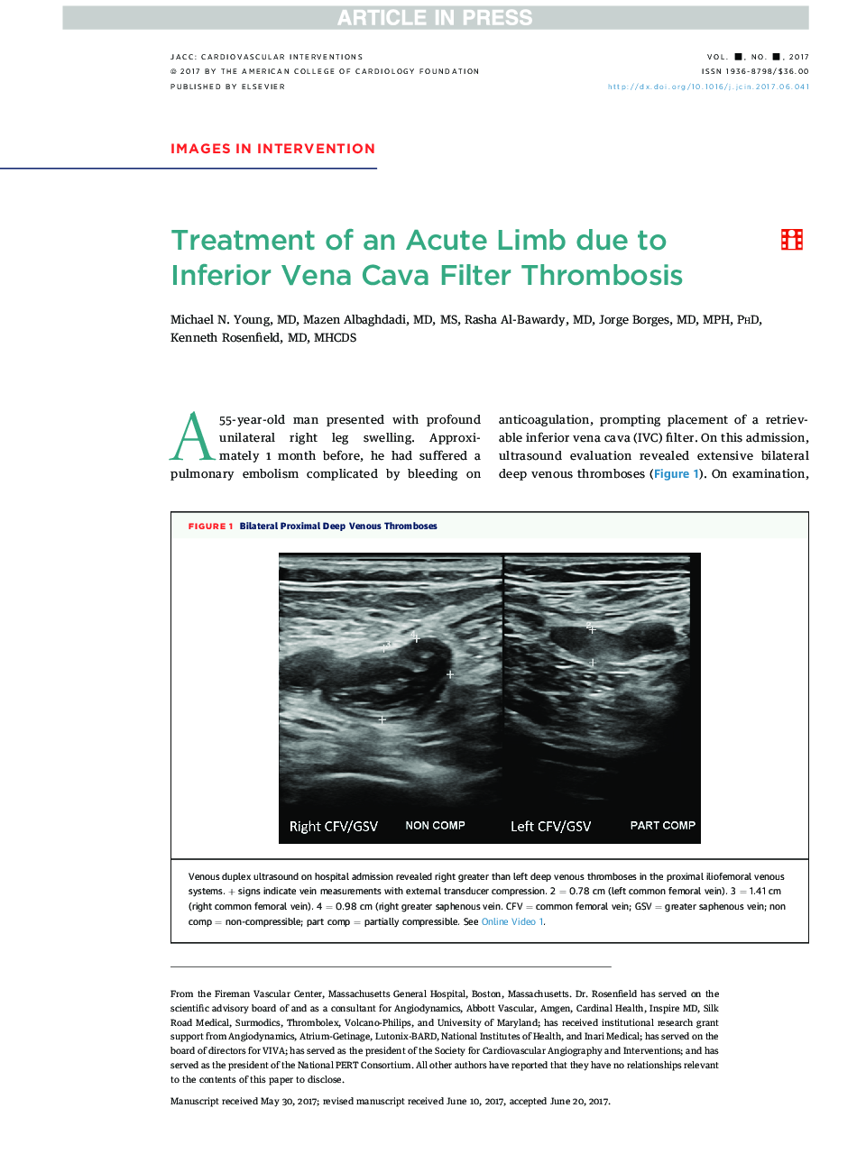 Treatment of an Acute Limb Due to Inferior Vena Cava Filter Thrombosis