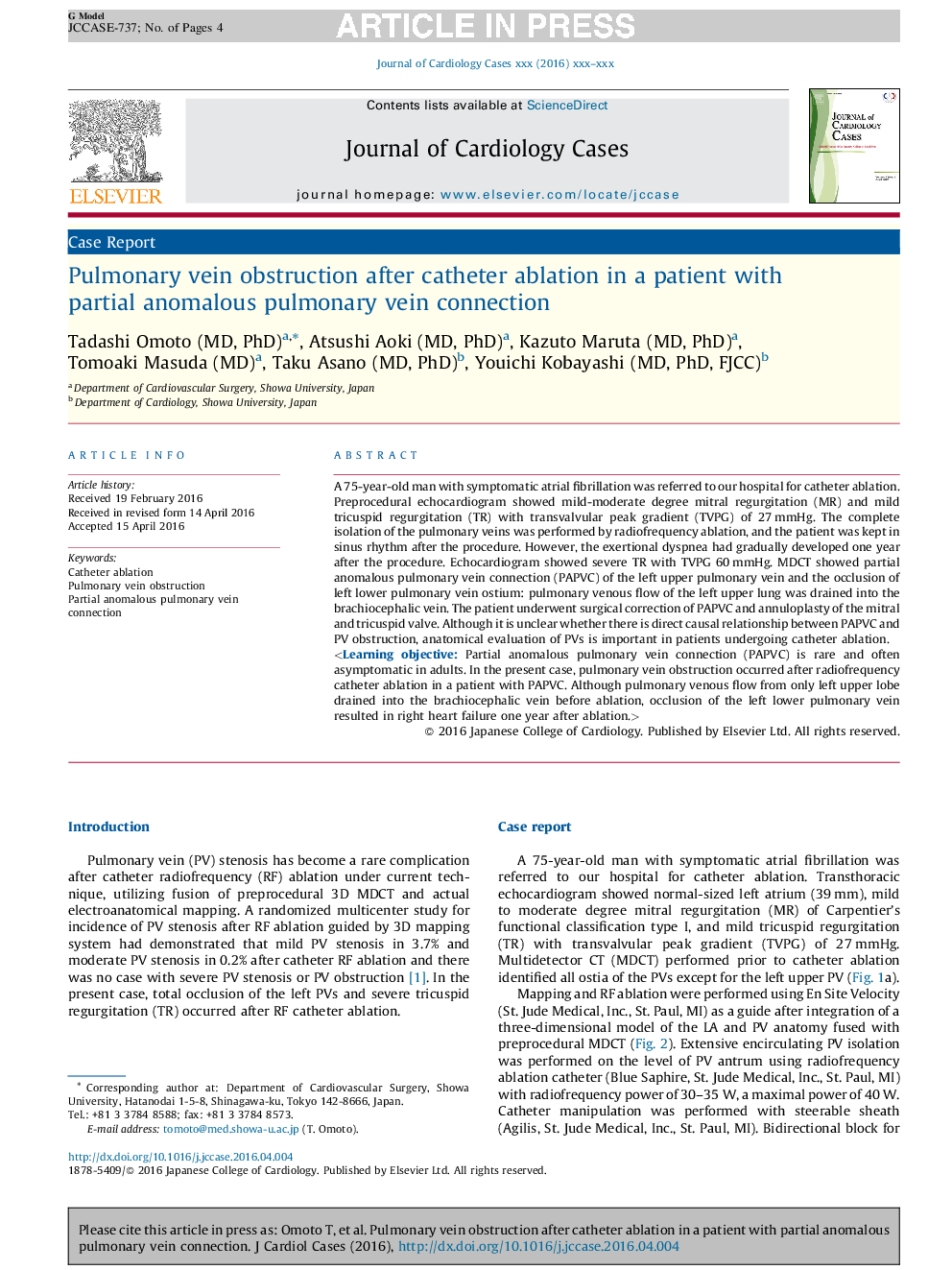 Pulmonary vein obstruction after catheter ablation in a patient with partial anomalous pulmonary vein connection