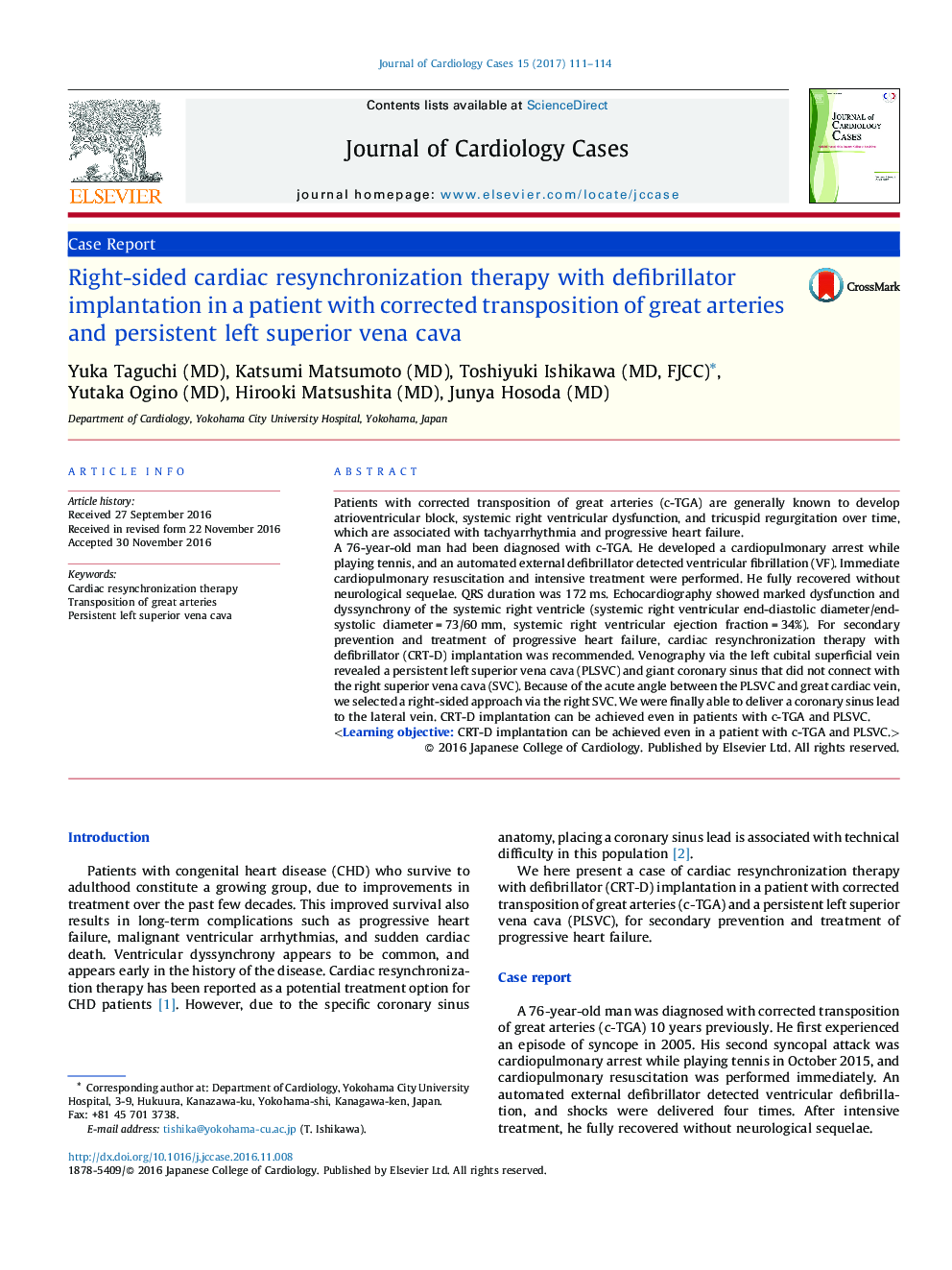 Right-sided cardiac resynchronization therapy with defibrillator implantation in a patient with corrected transposition of great arteries and persistent left superior vena cava