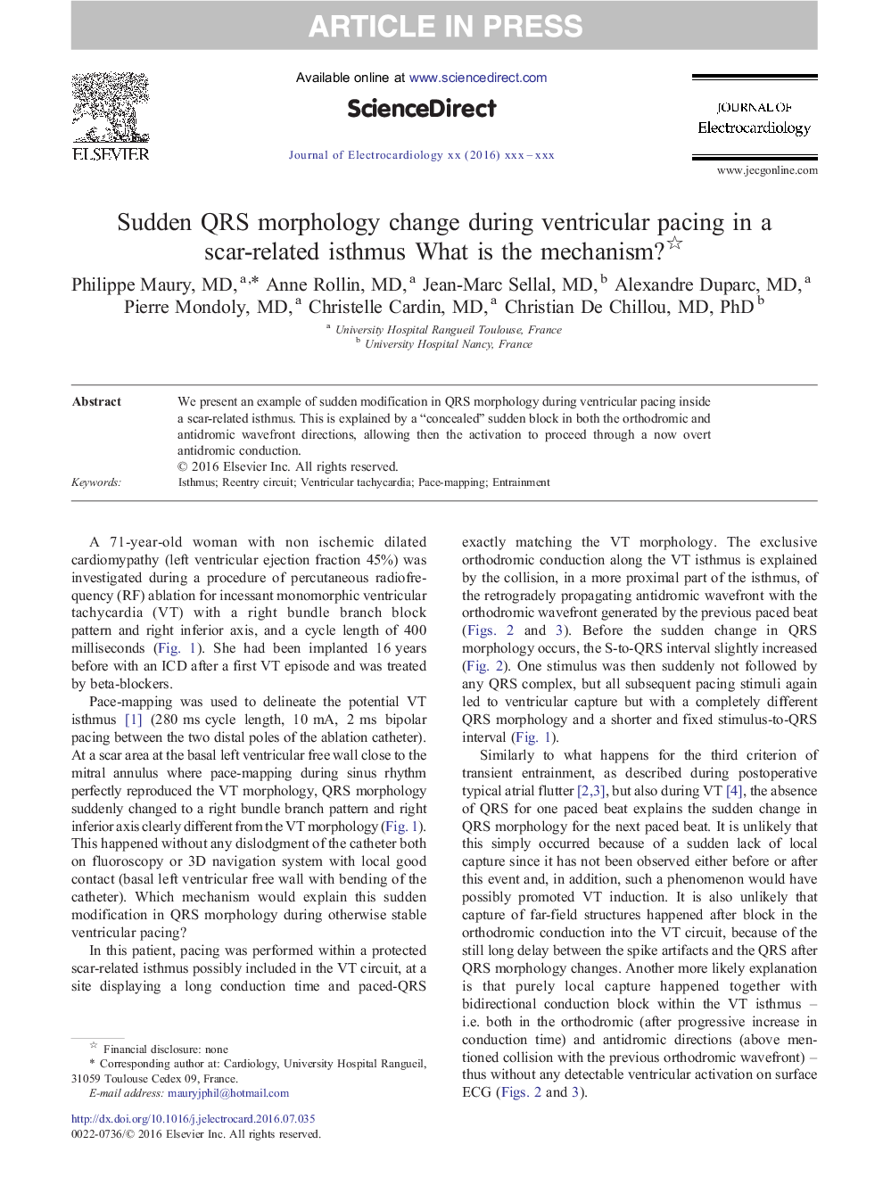 Sudden QRS morphology change during ventricular pacing in a scar-related isthmus What is the mechanism?