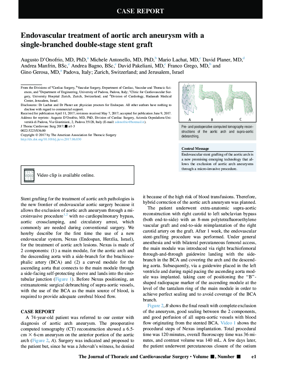 Endovascular treatment of aortic arch aneurysm with a single-branched double-stage stent graft