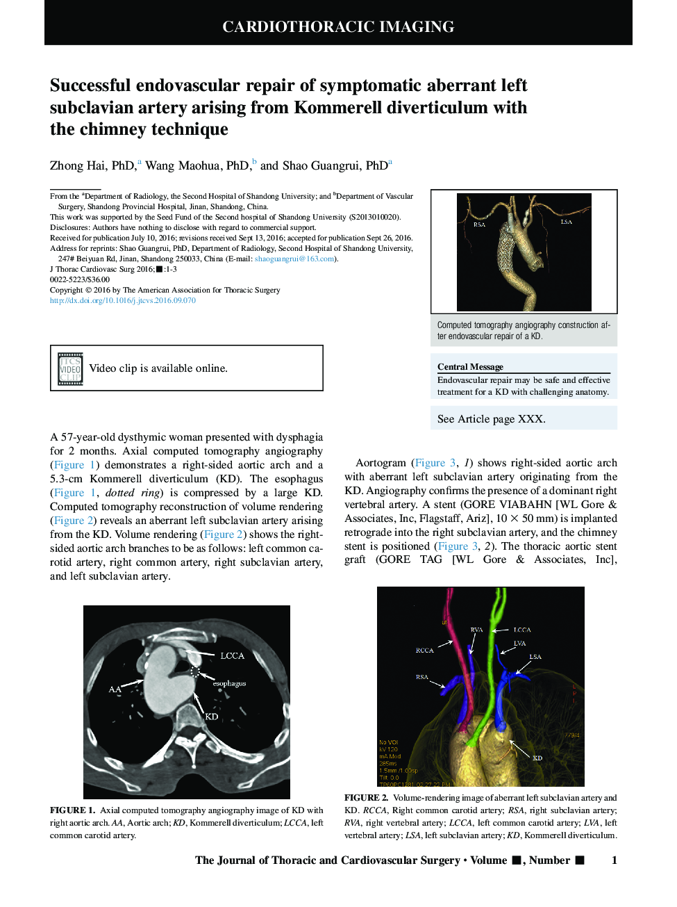Successful endovascular repair of symptomatic aberrant left subclavian artery arising from Kommerell diverticulum with the chimney technique