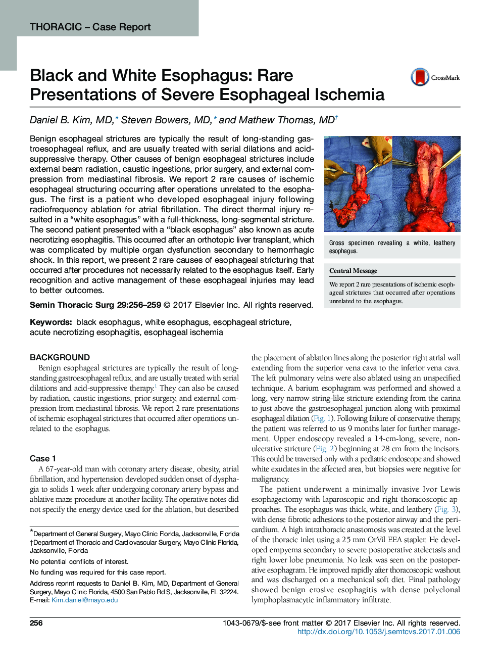 Thoracic - Case ReportBlack and White Esophagus: Rare Presentations of Severe Esophageal Ischemia