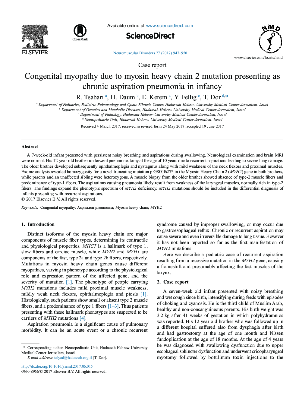 گزارش موردی میوپاتی کنگنیتال به علت جهش زنجیره سنگین میوزین 2 که به عنوان پنومونی آسپیراسیون مزمن در دوران کودکی 