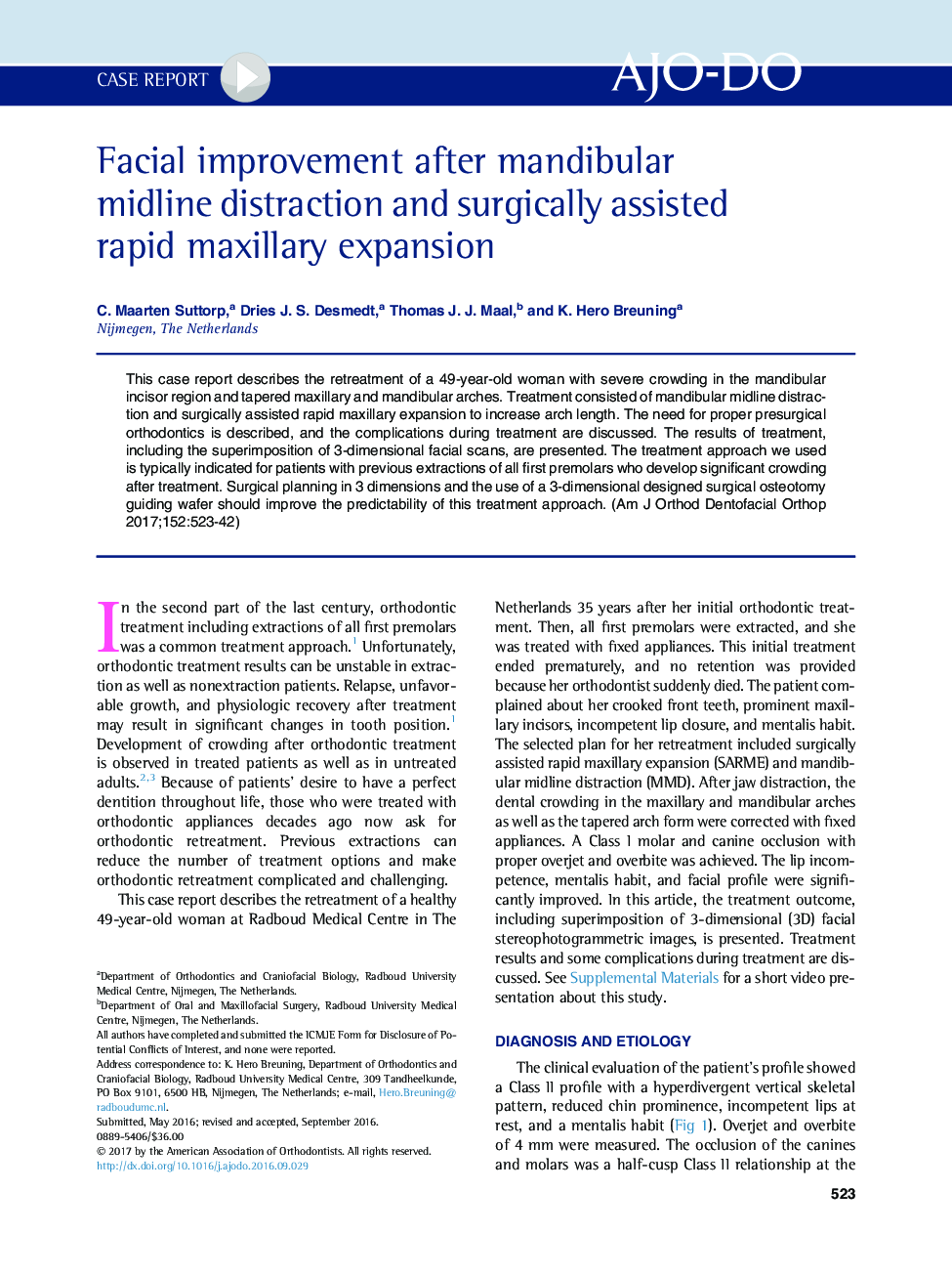 Facial improvement after mandibular midline distraction and surgically assisted rapid maxillary expansion