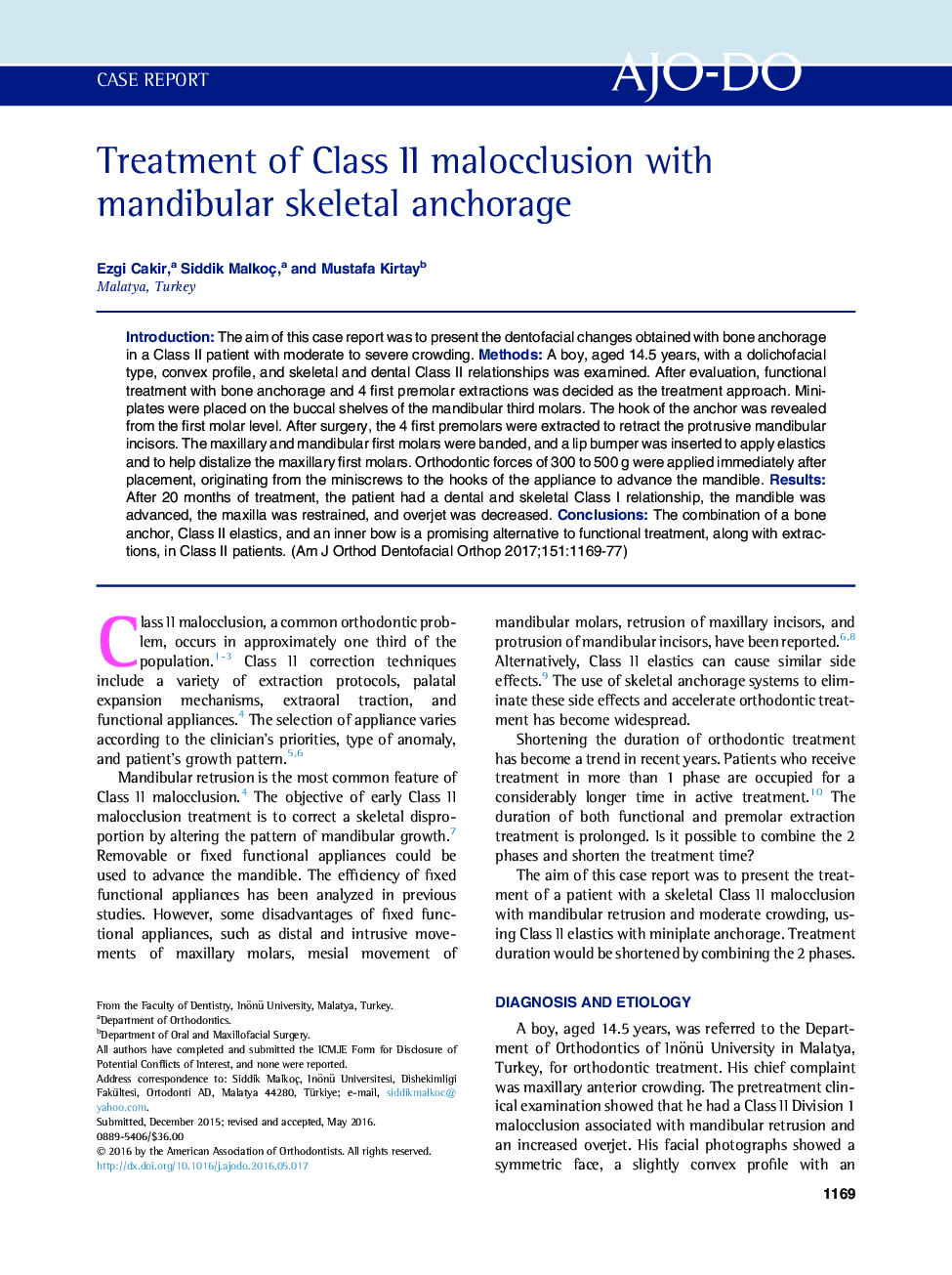 Treatment of Class II malocclusion with mandibular skeletal anchorage