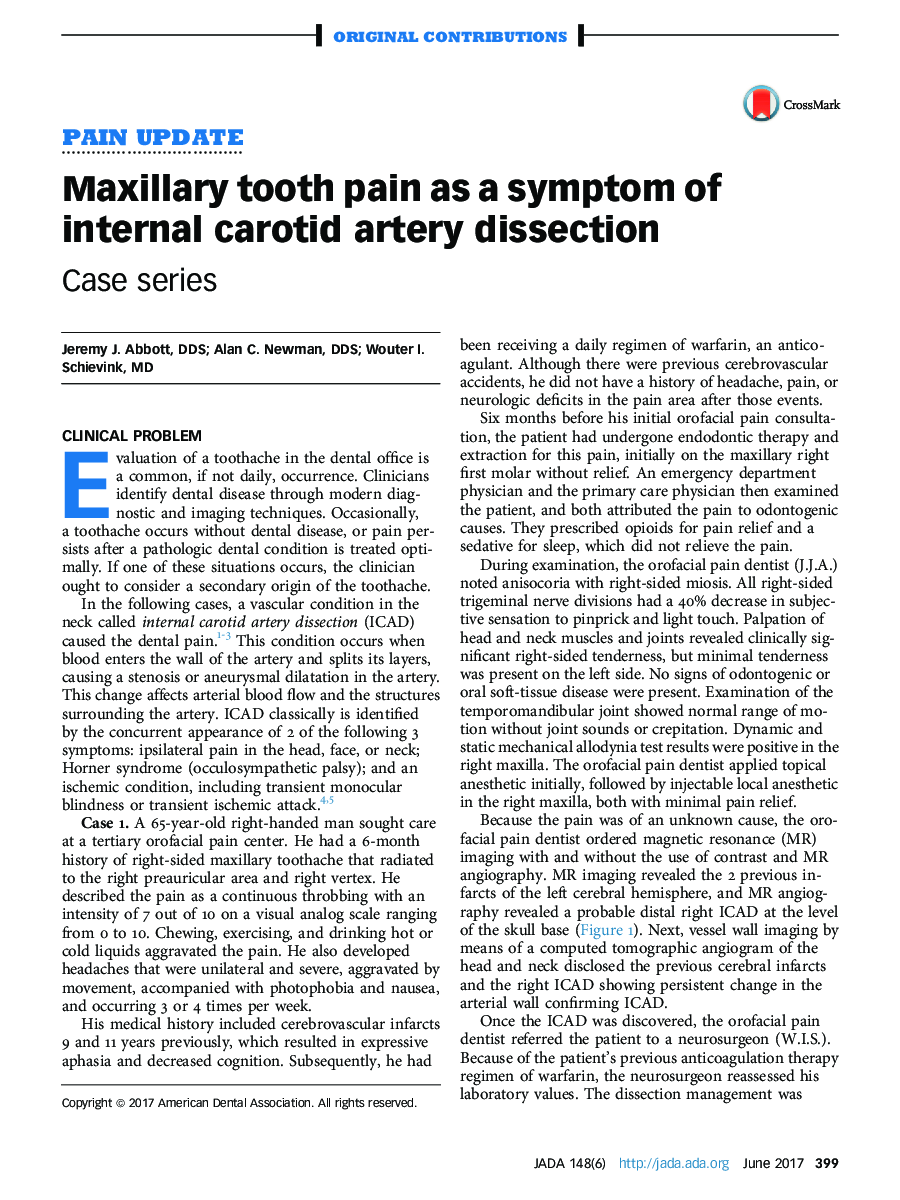 Maxillary tooth pain as a symptom of internal carotid artery dissection
