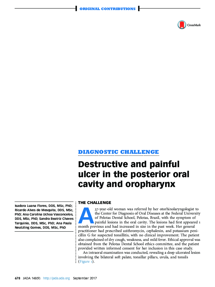 Destructive and painful ulcer in the posterior oral cavity and oropharynx