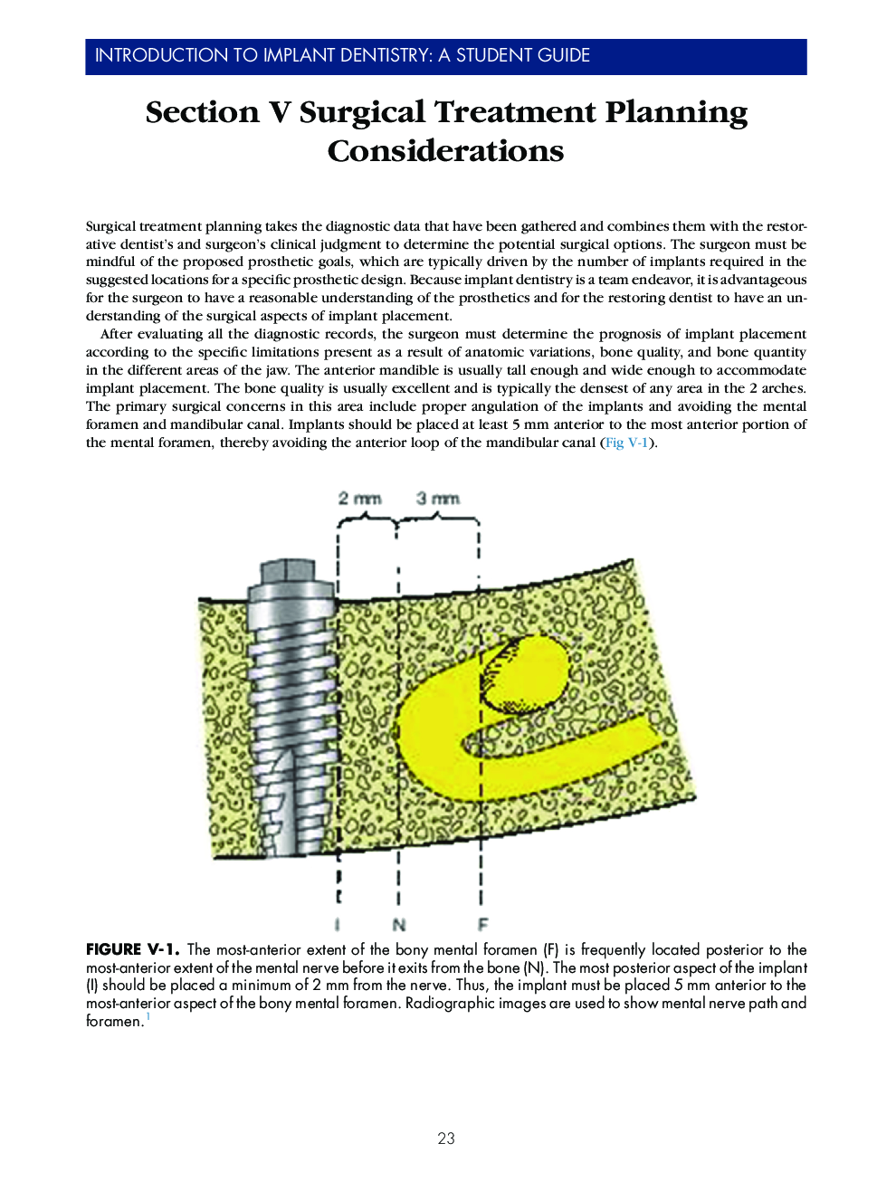 Section V Surgical Treatment Planning Considerations