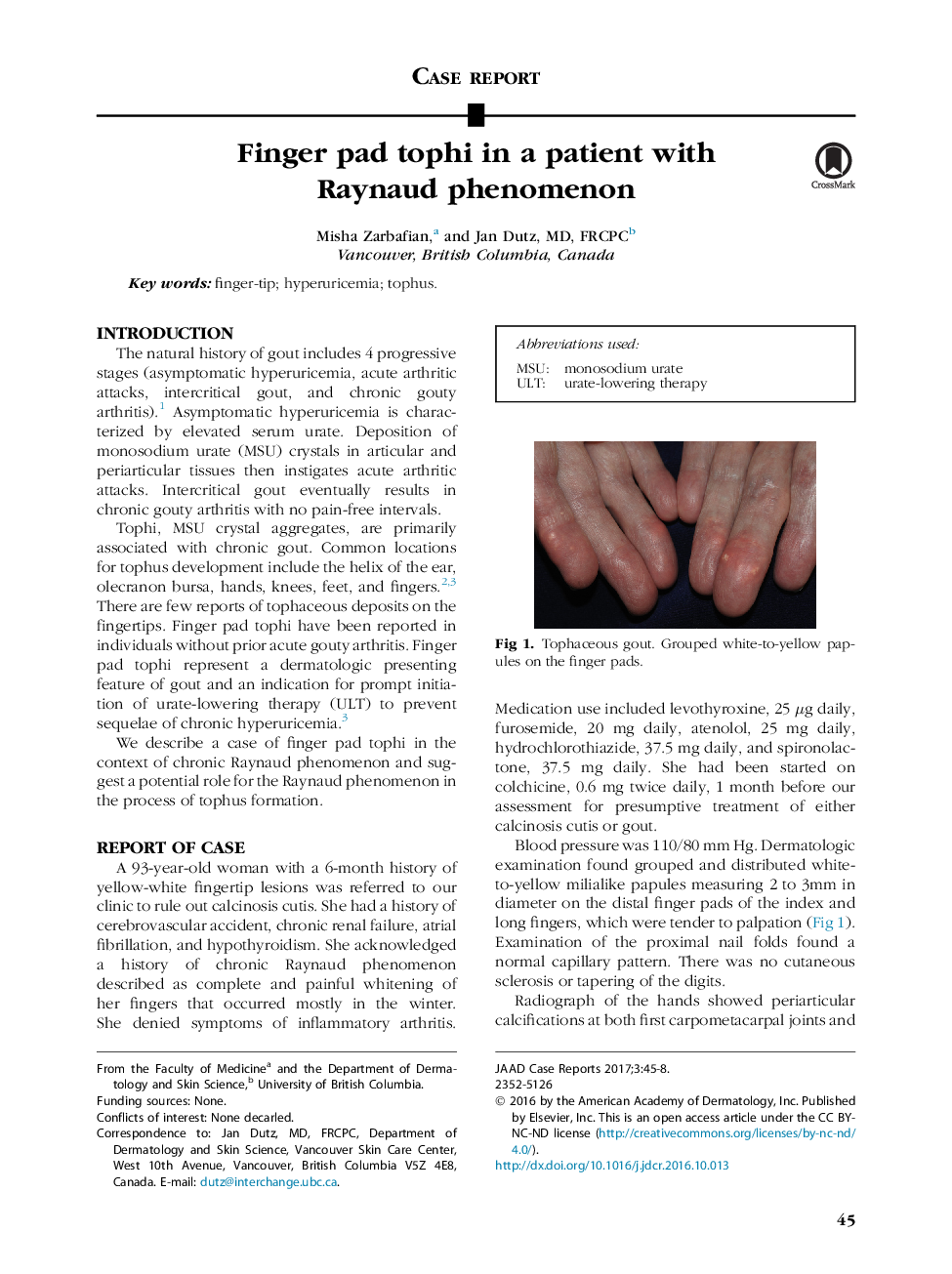 Finger pad tophi in a patient with Raynaud phenomenon