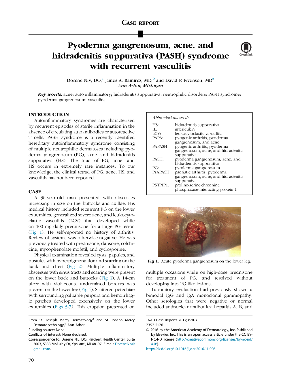 Pyoderma gangrenosum, acne, and hidradenitis suppurativa (PASH) syndrome with recurrent vasculitis