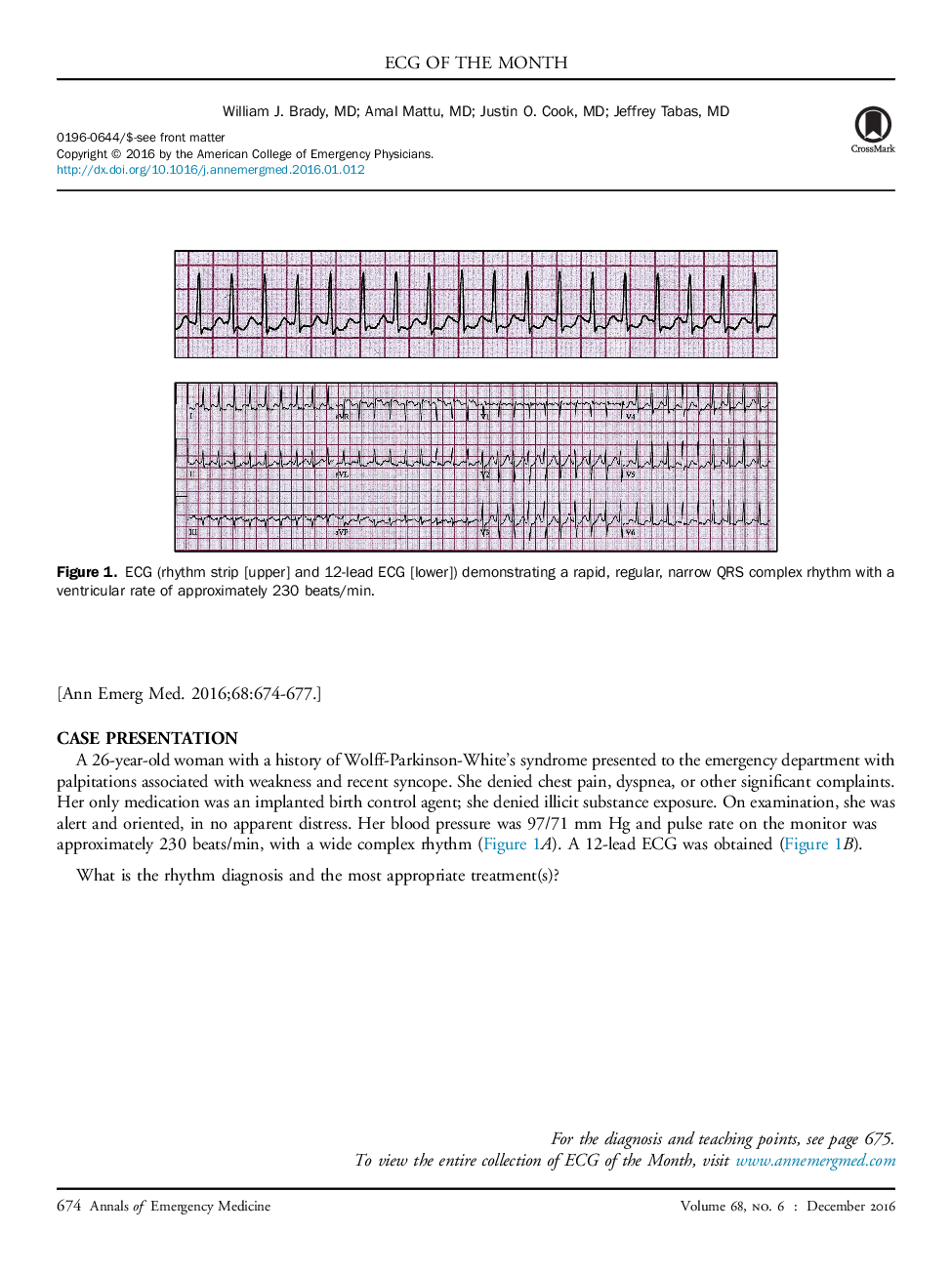 Female With Palpitations and Weakness