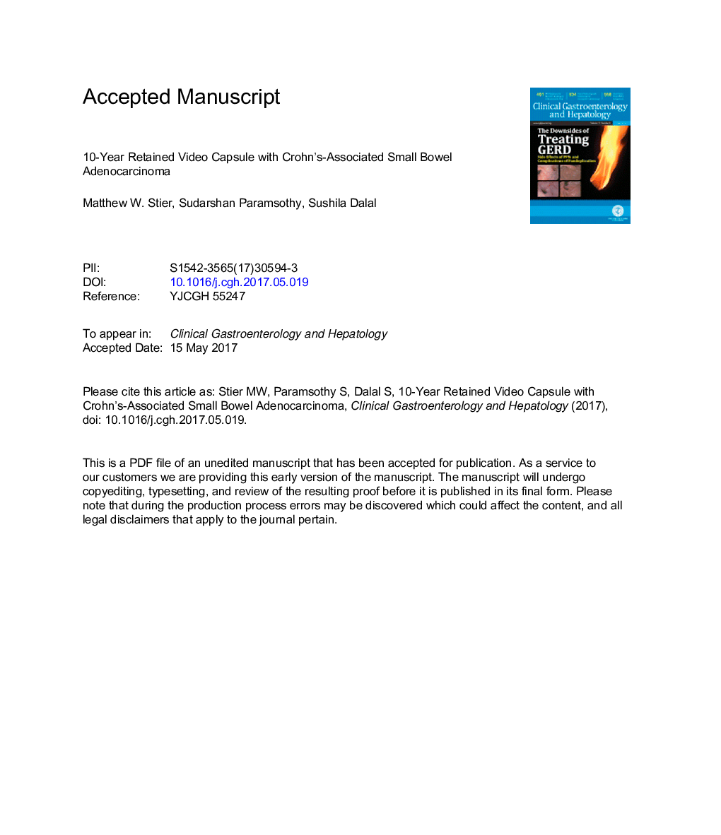 Ten-Year Retained Video Capsule With Crohn's-Associated Small-Bowel Adenocarcinoma