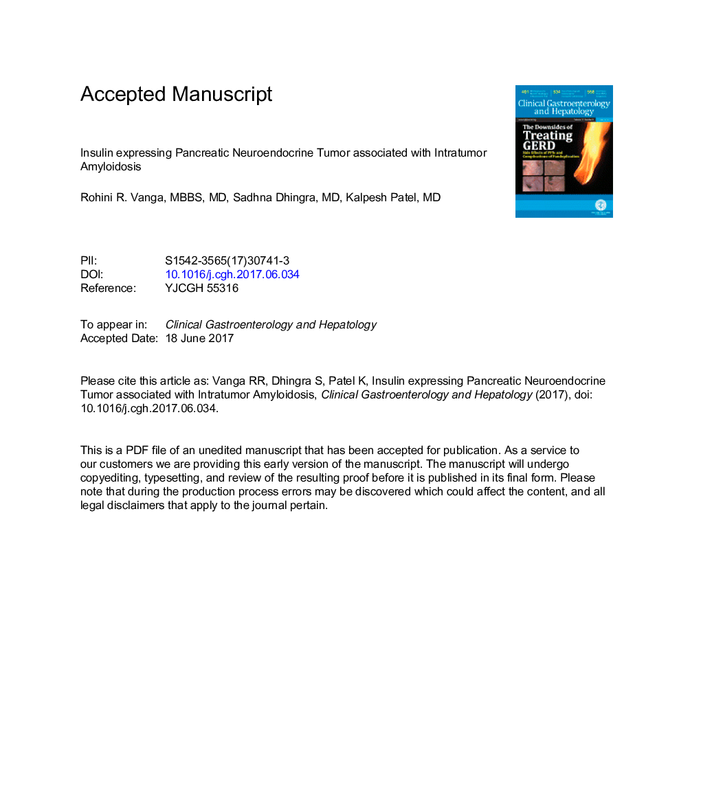 Insulin Expressing Pancreatic Neuroendocrine Tumor Associated With Intratumor Amyloidosis