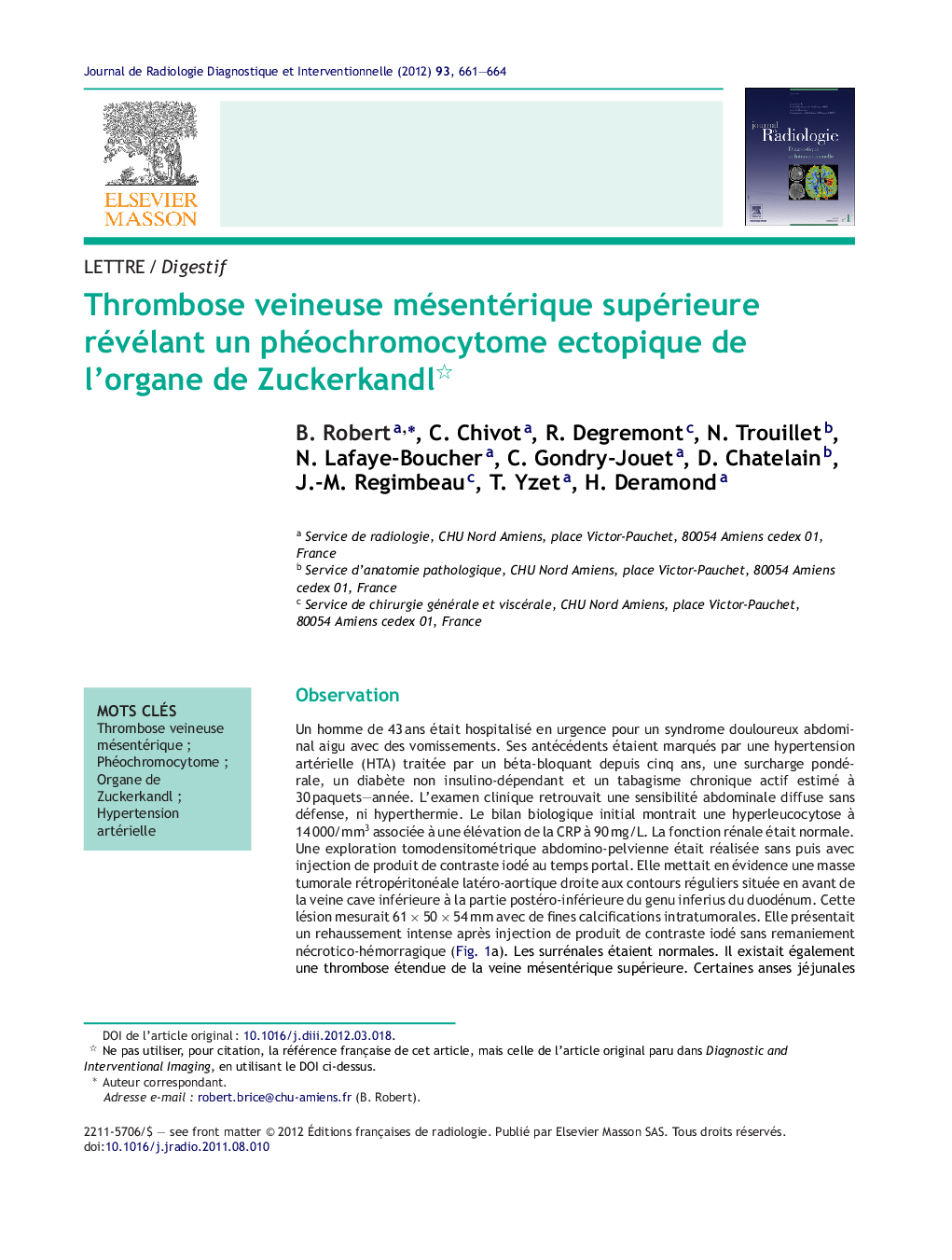 Thrombose veineuse mésentérique supérieure révélant un phéochromocytome ectopique de l'organe de Zuckerkandl