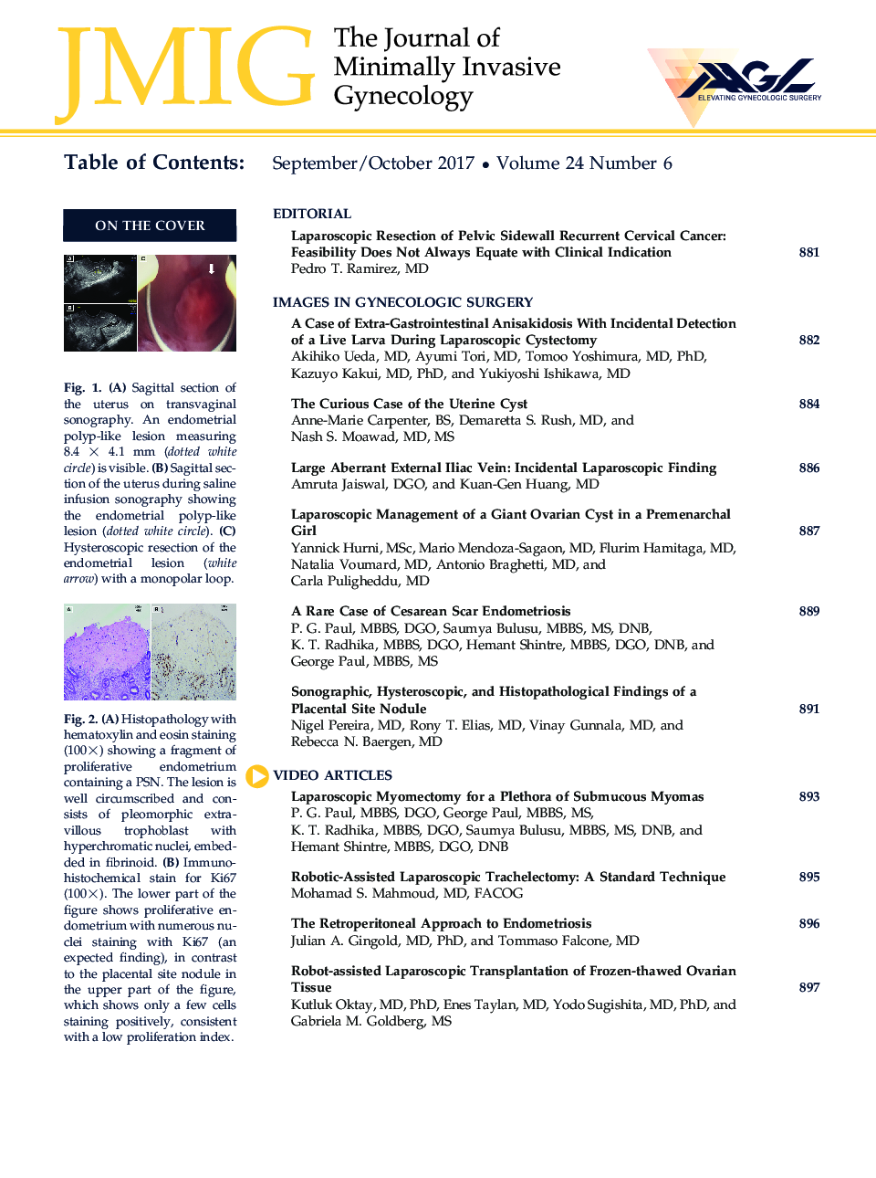 Table of Contents