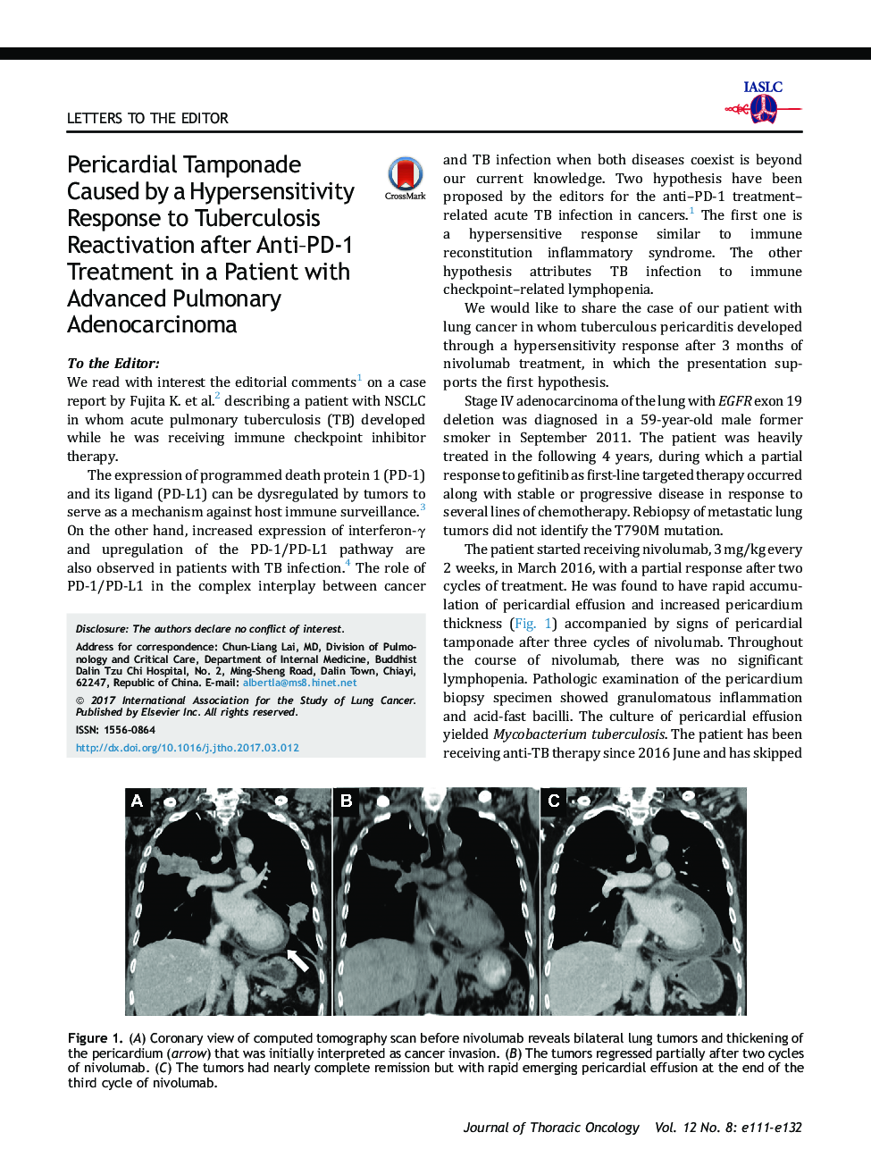Pericardial Tamponade Caused by a Hypersensitivity Response to Tuberculosis Reactivation after Anti-PD-1 Treatment in a Patient with Advanced Pulmonary Adenocarcinoma