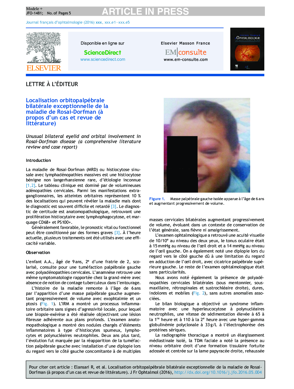 عکس صفحه اول مقاله: Localisation orbitopalpébrale bilatérale exceptionnelle de la maladie de Rosai-Dorfman (Ã propos d'un cas et revue de littérature) Localisation orbitopalpébrale bilatérale exceptionnelle de la maladie de Rosai-Dorfman (Ã propos d'un cas et revue de littérature)